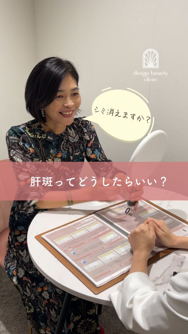 ✨
シミ治療でご来院の患者様の福崎院長とのご相談の様子のレポートです✨

もともとはIPL治療のルメッカをご希望でしたが、肝斑があるため、内服とピコトーニングで改善していくことになりました👩‍⚕️💡

ピコトーニングはダウンタイムもなく
予定の調整など必要ないので
気軽に継続していただけます🫶

ピコトーニングは、1回で劇的な変化を得るのは
難しいですが、回数を重ねることで
「続けてよかった！」とおっしゃっていただける
ような結果が期待できます🙆‍♀️

シミ治療はシミの種類によって最適な方法が変わりますので、悩んでいらっしゃる方はお気軽に無料カウンセリングにご来院くださいませ😊

【㊗️フォロワー5000人達成記念価格】

下記2種類のアカウントフォローで
💰初回価格：5,500円（税込）❣️
@designbeautyclinic 
@artmake_by_designbeautyclinic 

※当院ではじめてピコトーニングを受ける方限定です。
※キャンペーンは予告なく終了いたします。

☆通常価格：15,800円

・カウンセリング+施術時間：約1時間
・施術中の痛み：ゴムで弾かれたような体感
（※個人差あり。）
・ダウンタイム：ほぼ無し
（※個人差あり。稀に膨隆疹、赤み、乾燥）
・施術後のメイク：即可能
・効果：肝斑改善、しみ、くすみ、
肌のハリ改善、毛穴の開き改善

————————————

ACCESS：大阪府大阪市北区茶屋町15-8
茶屋町ビル2階
TEL：06-6743-4652
営業時間：10時〜17時
(最終受付時間：16時)
お問合せ受付時間：10時〜19時

#美容皮膚科 #美容外科 #美容クリニック #美肌 #女医 #美白 #アンチエイジング #シミ取り #レーザートーニング #肌質改善 #しみ #ハイフ #ウルトラセルQプラス #ルメッカ #フォトフェイシャル