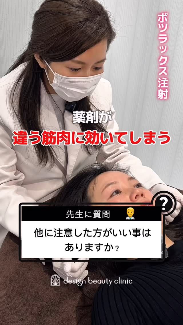 💉✨
ボツリヌストキシン注射
患者様からのご質問🙋‍♀️

美容クリニックがはじめての方にもわかりやすい動画です❤️
ぜひ参考にされてください☺️

・エラが張っていて顔が大きいのが悩み･･･
・睡眠時に歯ぎしりで悩んでいる･･･
・食いしばりのせいで頭痛がする･･･
・小顔になりたい！！
などのお悩みにはエラボツラックス✨

◇エラボツラックスの効果は？
日頃から歯ぎしりや食いしばりをして
しまう方は、その度に歯に体重の1.5倍
近い力が加わっていると言われています。
この食いしばりなどの癖により、
頬にある咬筋が過剰に発達してしまう
ことで、エラが張ってしまうのです。
ボツラックスを注射すると、顎の強い筋肉を
緩めることができるので、歯ぎしりや
食いしばりを緩和することができ、また
症状の1つでもある肩コリや頭痛が解消
され、エラの張りや首のむくみも解消し、
顔全体がすっきりとした印象になります。

～ボツラックスの効果持続期間～
個人差はありますが3～4ヶ月程度と
されています。
注射を行ってから2〜3日程度で
効果があらわれはじめ、徐々に
シワや多汗症などが改善されて、
徐々に筋肉が緩和し、
1ヶ月かけて身体に馴染んでいきます。

3〜4ヶ月をピークに徐々に効果が
薄れていき、治療から6ヶ月経つ頃
には効果もなくなっていることが
ほとんどです。
ボツラックス注射の効果を維持する
ために、4〜6ヶ月に一回定期的に
施術を受けることがお勧めです。

～ボツラックス注射がおすすめな方～
・エラが気になる
・フェイスラインをスッキリさせたい
・顔の表情ジワが気になる
・マッサージを受けても肩こりが治らない
・首から肩の華奢なラインに憧れる
・ワキガや多汗症で悩んでいる

■ボツラックス
ボツラックス（Botulax）は、韓国のHugel社が製造したA型ボツリヌス毒素を有効成分とする薬剤です。
承認状況：国内未承認
入手経路：PRSS社より入手
国内の承認医薬品などの有無：同一の成分や性能を有する他の国内承認医薬品等はありません
諸外国における安全性等に係る情報：韓国の食品医薬品安全庁（KFDA）

★エラ
☆Single：10,000円
☆double：16,000円
☆triple：25,000円
・カウンセリング+施術時間：30分
・施術中の痛み：チクっとした痛みあり
（※個人差あり）
（※表面麻酔希望の場合：+3,000円）
・ダウンタイム：内出血がでる場合もありますが、徐々に落ち着きます。
ボツラックスは熱に弱い為、薬剤が安定するまでの１週間は血行を促進させるサウナや岩盤浴などは控えてください。
・施術後のメイク：施術部位を避ければ当日から可能
・効果：表情ジワの改善、エラの改善、小顔効果、肩こり改善、多汗症の改善

⚠️DMでのお問い合わせはお受けしておりません
お問い合わせは、クリニックへ直接お電話をお願いいたします🌱

————————————

ACCESS：大阪府大阪市北区茶屋町15-8
茶屋町ビル2階
TEL：06-6743-4652
営業時間：10時〜17時
(最終受付時間：16時)
お問合せ受付時間：10時〜19時

#美容皮膚科 #美容外科 #美容クリニック #ボツラックス #ボトックス #しわ #エイジング #アンチエイジング #小顔