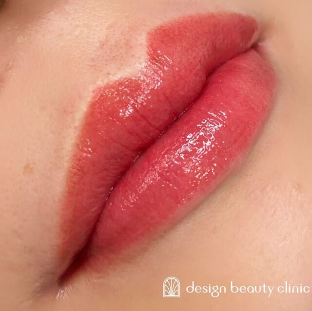 🫧
【リップアートメイクも人気です💋💫】

■お悩み・ご希望：
唇の色が薄く、血色を良くしたいとお悩み💭
■施術内容：
リップアートメイク

1回するだけでも、かなりトーンupしており
2回目でよりなりたい色へ近づけました🌷🌷

お写真ご協力ありがとうございました☺️

➤施術名：アートメイクリップ　1回44,000円（税込）
➤施術の説明：皮膚の浅い層を専用針で傷をつけて色素を入れることにより、皮膚を着色する施術です。
➤リスク・副作用：炎症症状(発赤・腫脹・熱感・疼痛)、内出血、痒み、アレルギー反応、感染等。

お問い合わせは、クリニックへ直接お電話をお願いいたします。

････････････････････････････････････････

■医療機関名
デザイン ビューティー クリニック

■ご予約方法
•WEB／LINE（プロフィールからリンクできます）
•電話

■電話番号（問い合わせ・予約）
メニューによって電話番号が異なります。

🌿アートメイク
　06-6616-8095

🌿美容皮膚科メニュー
　06-6743-4652

■店舗紹介
アートメイクは下記の3院どこでもお受けいただけます。

🏥梅田本院
〒530-0013 大阪府大阪市北区茶屋町15-8
茶屋町ビル2階

営業時間：10:00～19:00
定休日：不定休
診療メニュー：美容皮膚科 / アートメイク

🏥アートメイク梅田院
〒530-0014 大阪府大阪市北区鶴野町2-1
梅田タナダビル１階

営業時間：10:00～19:00
定休日：不定休
診療メニュー： アートメイク

🆕2025年1月6日開院✨
🏥アートメイク心斎橋院
〒542-0083 大阪市中央区東心斎橋1-20-14
心斎橋エルナ岩崎ビル5階

営業時間：10:00～19:00
定休日：不定休
診療メニュー： アートメイク

････････････････････････････････････････

#アートメイク #美容クリニック #アートメイク眉 #アートメイクリップ #眉アート #アートメイク大阪 #アートメイク梅田 #大阪 #梅田 #茶屋町 #心斎橋 #難波