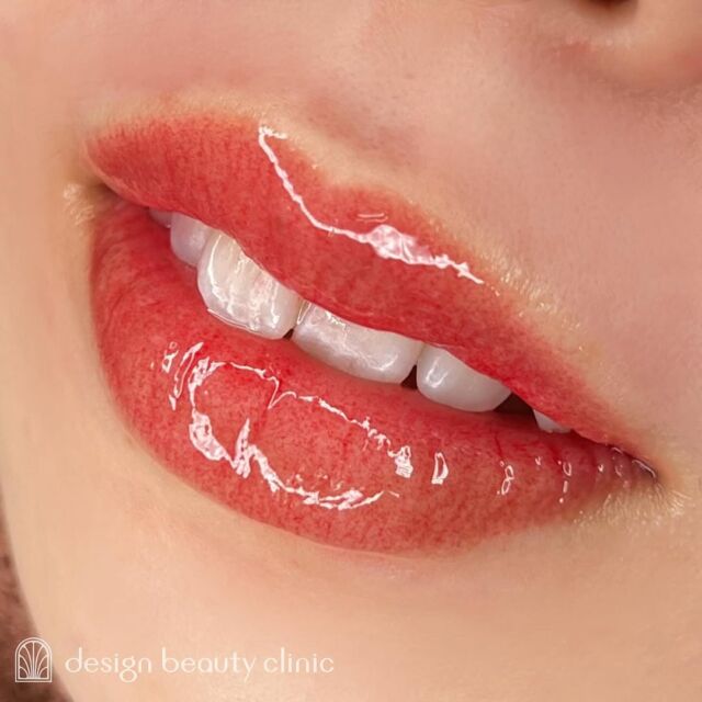 💋
■お悩み・ご希望：
唇の色が薄く顔色が悪く見えるとお悩みの患者さま🫧
ご希望の赤系のカラーで、血色アップを叶えました🍒✨
■施術内容：
リップアートメイク

お写真ご協力ありがとうございました☺️

➤施術名：アートメイクリップ　1回44,000円（税込）
➤施術の説明：皮膚の浅い層を専用針で傷をつけて色素を入れることにより、皮膚を着色する施術です。
➤リスク・副作用：炎症症状(発赤・腫脹・熱感・疼痛)、内出血、痒み、アレルギー反応、感染等。

⚠️DMでのお問い合わせはお受けしておりません
お問い合わせは、クリニックへ直接お電話をお願いいたします🌱

････････････････････････････････････････

■医療機関名
デザイン ビューティー クリニック

■ご予約方法
•WEB／LINE（プロフィールからリンクできます）
•電話

■電話番号（問い合わせ・予約）
メニューによって電話番号が異なります。

🌿アートメイク
　06-6616-8095

🌿美容皮膚科メニュー
　06-6743-4652

■店舗紹介
アートメイクは下記の3院どこでもお受けいただけます。

🏥梅田本院
〒530-0013 大阪府大阪市北区茶屋町15-8
茶屋町ビル2階

営業時間：10:00～19:00
定休日：不定休
診療メニュー：美容皮膚科 / アートメイク

🏥アートメイク梅田院
〒530-0014 大阪府大阪市北区鶴野町2-1
梅田タナダビル１階

営業時間：10:00～19:00
定休日：不定休
診療メニュー： アートメイク

🆕2025年1月6日開院✨
🏥アートメイク心斎橋院
〒542-0083 大阪市中央区東心斎橋1-20-14
心斎橋エルナ岩崎ビル5階

営業時間：10:00～19:00
定休日：不定休
診療メニュー： アートメイク

････････････････････････････････････････

#アートメイク #美容クリニック #アートメイク眉 #アートメイクリップ #眉アート #アートメイク大阪 #アートメイク梅田 #大阪 #梅田 #茶屋町 #心斎橋 #難波