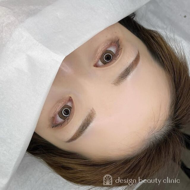 ■お悩み・ご希望：
全体的に眉が薄く、どのように描いたらいいかわからないとお悩み💭
できるだけナチュラルな感じで仕上げて欲しいとのことで
ご希望にそった自然な眉デザインを叶えました🪞🫧
■施術内容：
パウダー+毛並み(4D)

お写真ご協力ありがとうございました☺️

➤施術名：アートメイク眉毛　1回33,000円（税込）
➤施術の説明：皮膚の浅い層を専用針で傷をつけて色素を入れることにより、皮膚を着色する施術です。
➤リスク・副作用：炎症症状(発赤・腫脹・熱感・疼痛)、内出血、痒み、アレルギー反応、感染等。

⚠️DMでのお問い合わせはお受けしておりません
お問い合わせは、クリニックへ直接お電話をお願いいたします🌱

････････････････････････････････････････

■医療機関名
デザイン ビューティー クリニック

■ご予約方法
•WEB／LINE（プロフィールからリンクできます）
•電話

■電話番号（問い合わせ・予約）
メニューによって電話番号が異なります。

🌿アートメイク
　06-6616-8095

🌿美容皮膚科メニュー
　06-6743-4652

■店舗紹介
アートメイクは下記の3院どこでもお受けいただけます。

🏥梅田本院
〒530-0013 大阪府大阪市北区茶屋町15-8
茶屋町ビル2階

営業時間：10:00～19:00
定休日：不定休
診療メニュー：美容皮膚科 / アートメイク

🏥アートメイク梅田院
〒530-0014 大阪府大阪市北区鶴野町2-1
梅田タナダビル１階

営業時間：10:00～19:00
定休日：不定休
診療メニュー： アートメイク

🏥アートメイク心斎橋院
〒542-0083 大阪市中央区東心斎橋1-20-14
心斎橋エルナ岩崎ビル5階

営業時間：10:00～19:00
定休日：不定休
診療メニュー： アートメイク

････････････････････････････････････････

#アートメイク #美容クリニック #アートメイク眉 #アートメイクリップ #眉アート #アートメイク大阪 #アートメイク梅田 #大阪 #梅田 #茶屋町 #心斎橋 #難波