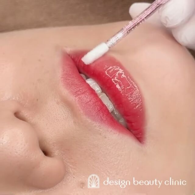 💋
■お悩み・ご希望：
唇に色が欲しいとご希望の患者さま🍒
赤ピンクが好きとのことで、
ご希望のカラーで血色アップを叶えました💖✨
■施術内容：
リップアートメイク

お写真ご協力ありがとうございました☺️

➤施術名：アートメイクリップ　1回44,000円（税込）
➤施術の説明：皮膚の浅い層を専用針で傷をつけて色素を入れることにより、皮膚を着色する施術です。
➤リスク・副作用：炎症症状(発赤・腫脹・熱感・疼痛)、内出血、痒み、アレルギー反応、感染等。

⚠️DMでのお問い合わせはお受けしておりません
お問い合わせは、クリニックへ直接お電話をお願いいたします🌱

････････････････････････････････････････

■医療機関名
デザイン ビューティー クリニック

■ご予約方法
•WEB／LINE（プロフィールからリンクできます）
•電話

■電話番号（問い合わせ・予約）
メニューによって電話番号が異なります。

🌿アートメイク
　06-6616-8095

🌿美容皮膚科メニュー
　06-6743-4652

■店舗紹介
アートメイクは下記の3院どこでもお受けいただけます。

🏥梅田本院
〒530-0013 大阪府大阪市北区茶屋町15-8
茶屋町ビル2階

営業時間：10:00～19:00
定休日：不定休
診療メニュー：美容皮膚科 / アートメイク

🏥アートメイク梅田院
〒530-0014 大阪府大阪市北区鶴野町2-1
梅田タナダビル１階

営業時間：10:00～19:00
定休日：不定休
診療メニュー： アートメイク

🆕2025年1月6日開院✨
🏥アートメイク心斎橋院
〒542-0083 大阪市中央区東心斎橋1-20-14
心斎橋エルナ岩崎ビル5階

営業時間：10:00～19:00
定休日：不定休
診療メニュー： アートメイク

････････････････････････････････････････

#アートメイク #美容クリニック #アートメイク眉 #アートメイクリップ #眉アート #アートメイク大阪 #アートメイク梅田 #大阪 #梅田 #茶屋町 #心斎橋 #難波