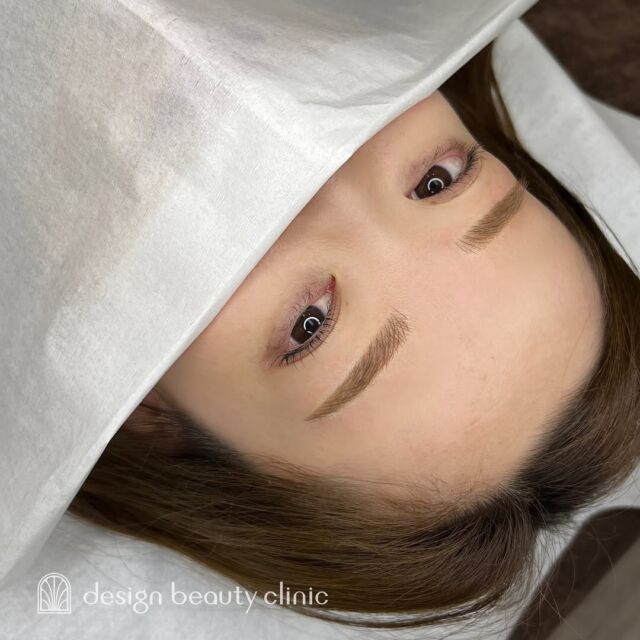 🪄
■お悩み・ご希望：
アート2回目の患者さま🪞🫧
メイクを楽にしたいとこのことで、
明るめの平行アーチをご希望でした🌼
■施術内容：
毛並み+パウダー(4D)

(投稿2枚目の初回定着は1回目施術より3ヶ月後の様子です)

お写真ご協力ありがとうございました☺️

➤施術名：アートメイク眉毛　1回33,000円（税込）
➤施術の説明：皮膚の浅い層を専用針で傷をつけて色素を入れることにより、皮膚を着色する施術です。
➤リスク・副作用：炎症症状(発赤・腫脹・熱感・疼痛)、内出血、痒み、アレルギー反応、感染等。

⚠️DMでのお問い合わせはお受けしておりません
お問い合わせは、クリニックへ直接お電話をお願いいたします🌱

････････････････････････････････････････

■医療機関名
デザイン ビューティー クリニック

■ご予約方法
•WEB／LINE（プロフィールからリンクできます）
•電話

■電話番号（問い合わせ・予約）
メニューによって電話番号が異なります。

🌿アートメイク
　06-6616-8095

🌿美容皮膚科メニュー
　06-6743-4652

■店舗紹介
アートメイクは下記の3院どこでもお受けいただけます。

🏥梅田本院
〒530-0013 大阪府大阪市北区茶屋町15-8
茶屋町ビル2階

営業時間：10:00～19:00
定休日：不定休
診療メニュー：美容皮膚科 / アートメイク

🏥アートメイク梅田院
〒530-0014 大阪府大阪市北区鶴野町2-1
梅田タナダビル１階

営業時間：10:00～19:00
定休日：不定休
診療メニュー： アートメイク

🏥アートメイク心斎橋院
〒542-0083 大阪市中央区東心斎橋1-20-14
心斎橋エルナ岩崎ビル5階

営業時間：10:00～19:00
定休日：不定休
診療メニュー： アートメイク

････････････････････････････････････････

#アートメイク #美容クリニック #アートメイク眉 #アートメイクリップ #眉アート #アートメイク大阪