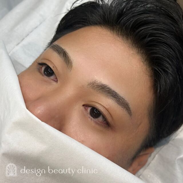 🪄
■お悩み・ご希望：
眉毛にもう少し濃さがほしいとご希望💭
自然な仕上がりにしてほしいとのことで、
毛並み(3D)でナチュラル眉を叶えました🪞💫
■施術内容：
毛並み(3D)

お写真ご協力ありがとうございました☺️

➤施術名：アートメイク眉毛　1回33,000円（税込）
➤施術の説明：皮膚の浅い層を専用針で傷をつけて色素を入れることにより、皮膚を着色する施術です。
➤リスク・副作用：炎症症状(発赤・腫脹・熱感・疼痛)、内出血、痒み、アレルギー反応、感染等。

⚠️DMでのお問い合わせはお受けしておりません
お問い合わせは、クリニックへ直接お電話をお願いいたします🌱

････････････････････････････････････････

■医療機関名
デザイン ビューティー クリニック

■ご予約方法
•WEB／LINE（プロフィールからリンクできます）
•電話

■電話番号（問い合わせ・予約）
メニューによって電話番号が異なります。

🌿アートメイク
　06-6616-8095

🌿美容皮膚科メニュー
　06-6743-4652

■店舗紹介
アートメイクは下記の3院どこでもお受けいただけます。

🏥梅田本院
〒530-0013 大阪府大阪市北区茶屋町15-8
茶屋町ビル2階

営業時間：10:00～19:00
定休日：不定休
診療メニュー：美容皮膚科 / アートメイク

🏥アートメイク梅田院
〒530-0014 大阪府大阪市北区鶴野町2-1
梅田タナダビル１階

営業時間：10:00～19:00
定休日：不定休
診療メニュー： アートメイク

🏥アートメイク心斎橋院
〒542-0083 大阪市中央区東心斎橋1-20-14
心斎橋エルナ岩崎ビル5階

営業時間：10:00～19:00
定休日：不定休
診療メニュー： アートメイク

････････････････････････････････････････

#アートメイク #美容クリニック #アートメイク眉 #アートメイクリップ #眉アート #アートメイク大阪