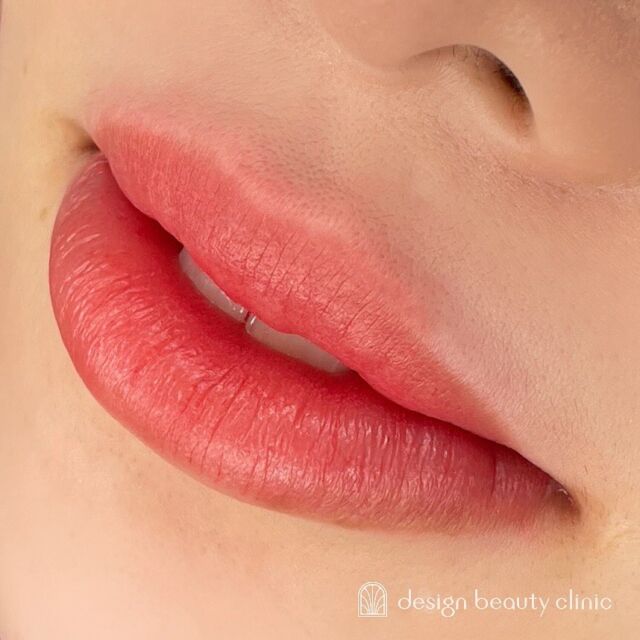 💋
■お悩み・ご希望：
年々唇の色がなくなってきたし、血色良くしたい✨
とご来院くださいました♪
少し腫れているのでふっくらしていますが、
だんだん晴れは引いてきます🪄
■施術内容：
リップアートメイク

お写真ご協力ありがとうございました☺️

➤施術名：アートメイクリップ　1回44,000円（税込）
➤施術の説明：皮膚の浅い層を専用針で傷をつけて色素を入れることにより、皮膚を着色する施術です。
➤リスク・副作用：炎症症状(発赤・腫脹・熱感・疼痛)、内出血、痒み、アレルギー反応、感染等。

⚠️DMでのお問い合わせはお受けしておりません
お問い合わせは、クリニックへ直接お電話をお願いいたします🌱

････････････････････････････････････････

■医療機関名
デザイン ビューティー クリニック

■ご予約方法
•WEB／LINE（プロフィールからリンクできます）
•電話

■電話番号（問い合わせ・予約）
メニューによって電話番号が異なります。

🌿アートメイク
　06-6616-8095

🌿美容皮膚科メニュー
　06-6743-4652

■店舗紹介
アートメイクは下記の3院どこでもお受けいただけます。

🏥梅田本院
〒530-0013 大阪府大阪市北区茶屋町15-8
茶屋町ビル2階

営業時間：10:00～19:00
定休日：不定休
診療メニュー：美容皮膚科 / アートメイク

🏥アートメイク梅田院
〒530-0014 大阪府大阪市北区鶴野町2-1
梅田タナダビル１階

営業時間：10:00～19:00
定休日：不定休
診療メニュー： アートメイク

🏥アートメイク心斎橋院
〒542-0083 大阪市中央区東心斎橋1-20-14
心斎橋エルナ岩崎ビル5階

営業時間：10:00～19:00
定休日：不定休
診療メニュー： アートメイク

････････････････････････････････････････

#アートメイク #美容クリニック #アートメイク眉 #アートメイクリップ #眉アート #アートメイク大阪