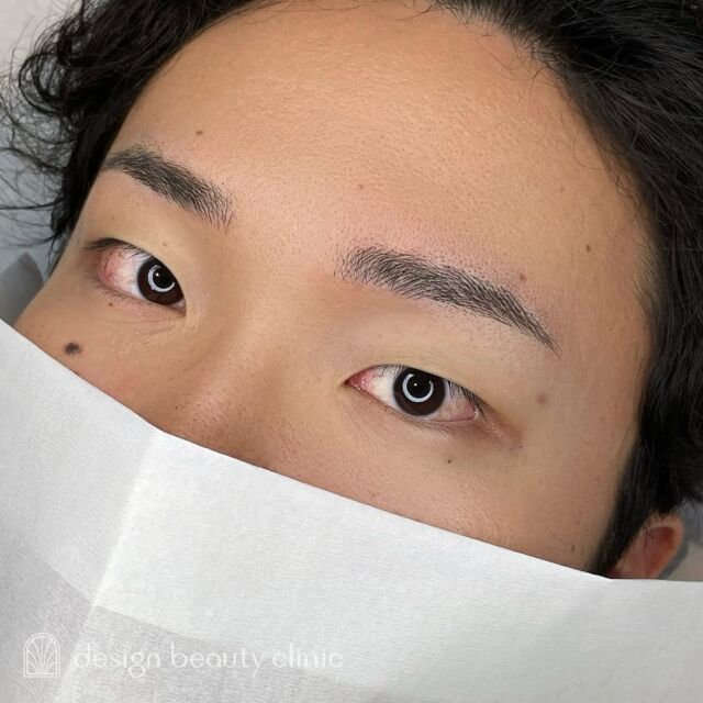 🪄
■お悩み・ご希望：
眉尻の自眉が薄いとお悩み💭
自然に整っている眉にしてほしいとご希望で
ナチュラルな雰囲気に仕上げました💫
■施術内容：
毛並み(3D)

お写真ご協力ありがとうございました☺️

➤施術名：アートメイク眉毛　1回33,000円（税込）
➤施術の説明：皮膚の浅い層を専用針で傷をつけて色素を入れることにより、皮膚を着色する施術です。
➤リスク・副作用：炎症症状(発赤・腫脹・熱感・疼痛)、内出血、痒み、アレルギー反応、感染等。

⚠️DMでのお問い合わせはお受けしておりません
お問い合わせは、クリニックへ直接お電話をお願いいたします🌱

････････････････････････････････････････

■医療機関名
デザイン ビューティー クリニック

■ご予約方法
•WEB／LINE（プロフィールからリンクできます）
•電話

■電話番号（問い合わせ・予約）
メニューによって電話番号が異なります。

🌿アートメイク
　06-6616-8095

🌿美容皮膚科メニュー
　06-6743-4652

■店舗紹介
アートメイクは下記の3院どこでもお受けいただけます。

🏥梅田本院
〒530-0013 大阪府大阪市北区茶屋町15-8
茶屋町ビル2階

営業時間：10:00～19:00
定休日：不定休
診療メニュー：美容皮膚科 / アートメイク

🏥アートメイク梅田院
〒530-0014 大阪府大阪市北区鶴野町2-1
梅田タナダビル１階

営業時間：10:00～19:00
定休日：不定休
診療メニュー： アートメイク

🏥アートメイク心斎橋院
〒542-0083 大阪市中央区東心斎橋1-20-14
心斎橋エルナ岩崎ビル5階

営業時間：10:00～19:00
定休日：不定休
診療メニュー： アートメイク

････････････････････････････････････････

#アートメイク #美容クリニック #アートメイク眉 #アートメイクリップ #眉アート #アートメイク大阪
