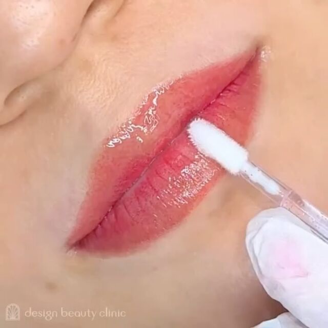 💋
■お悩み・ご希望：
茶ぐすみがあり、血色が悪く見える...とお悩み💭
血色を良くしたいとご来院くださいました🍒✨
■施術内容：
リップアートメイク

お写真ご協力ありがとうございました☺️

➤施術名：アートメイクリップ　1回44,000円（税込）
➤施術の説明：皮膚の浅い層を専用針で傷をつけて色素を入れることにより、皮膚を着色する施術です。
➤リスク・副作用：炎症症状(発赤・腫脹・熱感・疼痛)、内出血、痒み、アレルギー反応、感染等。

⚠️DMでのお問い合わせはお受けしておりません
お問い合わせは、クリニックへ直接お電話をお願いいたします🌱

････････････････････････････････････････

■医療機関名
デザイン ビューティー クリニック

■ご予約方法
•WEB／LINE（プロフィールからリンクできます）
•電話

■電話番号（問い合わせ・予約）
メニューによって電話番号が異なります。

🌿アートメイク
　06-6616-8095

🌿美容皮膚科メニュー
　06-6743-4652

■店舗紹介
アートメイクは下記の3院どこでもお受けいただけます。

🏥梅田本院
〒530-0013 大阪府大阪市北区茶屋町15-8
茶屋町ビル2階

営業時間：10:00～19:00
定休日：不定休
診療メニュー：美容皮膚科 / アートメイク

🏥アートメイク梅田院
〒530-0014 大阪府大阪市北区鶴野町2-1
梅田タナダビル１階

営業時間：10:00～19:00
定休日：不定休
診療メニュー： アートメイク

🏥アートメイク心斎橋院
〒542-0083 大阪市中央区東心斎橋1-20-14
心斎橋エルナ岩崎ビル5階

営業時間：10:00～19:00
定休日：不定休
診療メニュー： アートメイク

････････････････････････････････････････

#アートメイク #美容クリニック #アートメイク眉 #アートメイクリップ #眉アート #アートメイク大阪