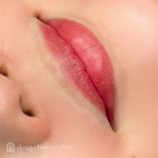 💋
■お悩み・ご希望：
血色とくすみが気になっている...とお悩み💬
アートメイクで血色の良い唇になりました🍒✨
■施術内容：
リップアートメイク

お写真ご協力ありがとうございました☺️

➤施術名：アートメイクリップ　1回44,000円（税込）
➤施術の説明：皮膚の浅い層を専用針で傷をつけて色素を入れることにより、皮膚を着色する施術です。
➤リスク・副作用：炎症症状(発赤・腫脹・熱感・疼痛)、内出血、痒み、アレルギー反応、感染等。

⚠️DMでのお問い合わせはお受けしておりません
お問い合わせは、クリニックへ直接お電話をお願いいたします🌱

････････････････････････････････････････

■医療機関名
デザイン ビューティー クリニック

■ご予約方法
•WEB／LINE（プロフィールからリンクできます）
•電話

■電話番号（問い合わせ・予約）
メニューによって電話番号が異なります。

🌿アートメイク
　06-6616-8095

🌿美容皮膚科メニュー
　06-6743-4652

■店舗紹介
アートメイクは下記の3院どこでもお受けいただけます。

🏥梅田本院
〒530-0013 大阪府大阪市北区茶屋町15-8
茶屋町ビル2階

営業時間：10:00～19:00
定休日：不定休
診療メニュー：美容皮膚科 / アートメイク

🏥アートメイク梅田院
〒530-0014 大阪府大阪市北区鶴野町2-1
梅田タナダビル１階

営業時間：10:00～19:00
定休日：不定休
診療メニュー： アートメイク

🏥アートメイク心斎橋院
〒542-0083 大阪市中央区東心斎橋1-20-14
心斎橋エルナ岩崎ビル5階

営業時間：10:00～19:00
定休日：不定休
診療メニュー： アートメイク

････････････････････････････････････････

#アートメイク #美容クリニック #アートメイク眉 #アートメイクリップ #眉アート #アートメイク大阪