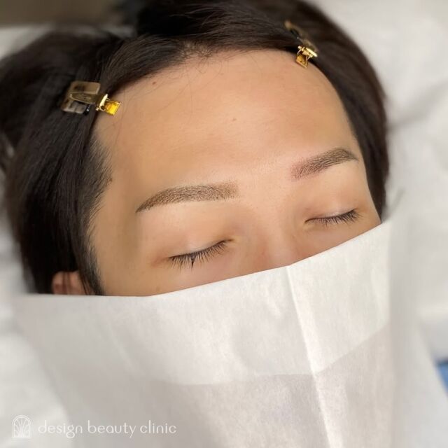 🪄
■お悩み・ご希望：
ずっと前から気にはなっていて、
眉を整えてかっこよくなりたいです！✨との
ご希望でご来院いただきました💫
■施術内容：
パウダー(2D)

お写真ご協力ありがとうございました☺️

➤施術名：アートメイク眉毛　1回33,000円（税込）
➤施術の説明：皮膚の浅い層を専用針で傷をつけて色素を入れることにより、皮膚を着色する施術です。
➤リスク・副作用：炎症症状(発赤・腫脹・熱感・疼痛)、内出血、痒み、アレルギー反応、感染等。

⚠️DMでのお問い合わせはお受けしておりません
お問い合わせは、クリニックへ直接お電話をお願いいたします🌱

････････････････････････････････････････

■医療機関名
デザイン ビューティー クリニック

■ご予約方法
•WEB／LINE（プロフィールからリンクできます）
•電話

■電話番号（問い合わせ・予約）
メニューによって電話番号が異なります。

🌿アートメイク
　06-6616-8095

🌿美容皮膚科メニュー
　06-6743-4652

■店舗紹介
アートメイクは下記の3院どこでもお受けいただけます。

🎀梅田エリアで通いやすい方はこちら🎀
🏥梅田本院
〒530-0013 大阪府大阪市北区茶屋町15-8
茶屋町ビル2階

営業時間：10:00～19:00
定休日：不定休
診療メニュー：美容皮膚科 / アートメイク

🏥アートメイク梅田院
〒530-0014 大阪府大阪市北区鶴野町2-1
梅田タナダビル１階

営業時間：10:00～19:00
定休日：不定休
診療メニュー： アートメイク

🎀 心斎橋・難波(なんば)エリアで通いやすい方はこちら🎀
🏥アートメイク心斎橋院
〒542-0083 大阪市中央区東心斎橋1-20-14
心斎橋エルナ岩崎ビル5階

営業時間：10:00～19:00
定休日：不定休
診療メニュー： アートメイク

････････････････････････････････････････

#アートメイク #美容クリニック #アートメイク眉 #アートメイクリップ #眉アート #アートメイク大阪 #梅田 #心斎橋 #難波