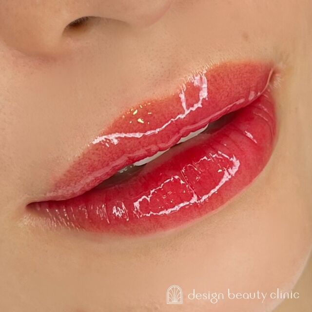 💋
■お悩み・ご希望：
時々、血色が悪く見えるのがお悩み🫧
ご希望の落ち着いた濃いめ赤系のカラーで仕上げました🍒✨
■施術内容：
リップアートメイク

お写真ご協力ありがとうございました☺️

➤施術名：アートメイクリップ　1回44,000円（税込）
➤施術の説明：皮膚の浅い層を専用針で傷をつけて色素を入れることにより、皮膚を着色する施術です。
➤リスク・副作用：炎症症状(発赤・腫脹・熱感・疼痛)、内出血、痒み、アレルギー反応、感染等。

⚠️DMでのお問い合わせはお受けしておりません
お問い合わせは、クリニックへ直接お電話をお願いいたします🌱

････････････････････････････････････････

■医療機関名
デザイン ビューティー クリニック

■ご予約方法
•WEB／LINE（プロフィールからリンクできます）
•電話

■電話番号（問い合わせ・予約）
メニューによって電話番号が異なります。

🌿アートメイク
　06-6616-8095

🌿美容皮膚科メニュー
　06-6743-4652

■店舗紹介
アートメイクは下記の3院どこでもお受けいただけます。

🎀梅田エリアで通いやすい方はこちら🎀
🏥梅田本院
〒530-0013 大阪府大阪市北区茶屋町15-8
茶屋町ビル2階

営業時間：10:00～19:00
定休日：不定休
診療メニュー：美容皮膚科 / アートメイク

🏥アートメイク梅田院
〒530-0014 大阪府大阪市北区鶴野町2-1
梅田タナダビル１階

営業時間：10:00～19:00
定休日：不定休
診療メニュー： アートメイク

🎀 心斎橋・難波(なんば)エリアで通いやすい方はこちら🎀
🏥アートメイク心斎橋院
〒542-0083 大阪市中央区東心斎橋1-20-14
心斎橋エルナ岩崎ビル5階

営業時間：10:00～19:00
定休日：不定休
診療メニュー： アートメイク

････････････････････････････････････････

#アートメイク #美容クリニック #アートメイク眉 #アートメイクリップ #眉アート #アートメイク大阪 #梅田 #心斎橋 #難波