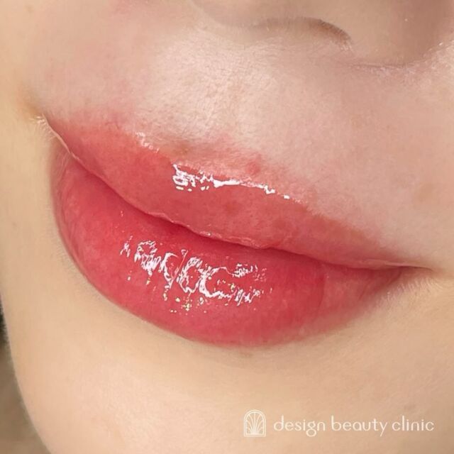 💋
■お悩み・ご希望：
濃すぎない程度に血色感上げたい！と今回リップアートメイク💋
元々濃い口紅を使わないとのことで、
自然な色味で調整させていただきました✨
■施術内容：
リップアートメイク

お写真ご協力ありがとうございました☺️

➤施術名：アートメイクリップ　1回44,000円（税込）
➤施術の説明：皮膚の浅い層を専用針で傷をつけて色素を入れることにより、皮膚を着色する施術です。
➤リスク・副作用：炎症症状(発赤・腫脹・熱感・疼痛)、内出血、痒み、アレルギー反応、感染等。

⚠️DMでのお問い合わせはお受けしておりません
お問い合わせは、クリニックへ直接お電話をお願いいたします🌱

････････････････････････････････････････

■医療機関名
デザイン ビューティー クリニック

■ご予約方法
•WEB／LINE（プロフィールからリンクできます）
•電話

■電話番号（問い合わせ・予約）
メニューによって電話番号が異なります。

🌿アートメイク
　06-6616-8095

🌿美容皮膚科メニュー
　06-6743-4652

■店舗紹介
アートメイクは下記の3院どこでもお受けいただけます。

🎀梅田エリアで通いやすい方はこちら🎀
🏥梅田本院
〒530-0013 大阪府大阪市北区茶屋町15-8
茶屋町ビル2階

営業時間：10:00～19:00
定休日：不定休
診療メニュー：美容皮膚科 / アートメイク

🏥アートメイク梅田院
〒530-0014 大阪府大阪市北区鶴野町2-1
梅田タナダビル１階

営業時間：10:00～19:00
定休日：不定休
診療メニュー： アートメイク

🎀 心斎橋・難波(なんば)エリアで通いやすい方はこちら🎀
🏥アートメイク心斎橋院
〒542-0083 大阪市中央区東心斎橋1-20-14
心斎橋エルナ岩崎ビル5階

営業時間：10:00～19:00
定休日：不定休
診療メニュー： アートメイク

････････････････････････････････････････

#アートメイク #美容クリニック #アートメイク眉 #アートメイクリップ #眉アート #アートメイク大阪 #梅田 #心斎橋 #難波