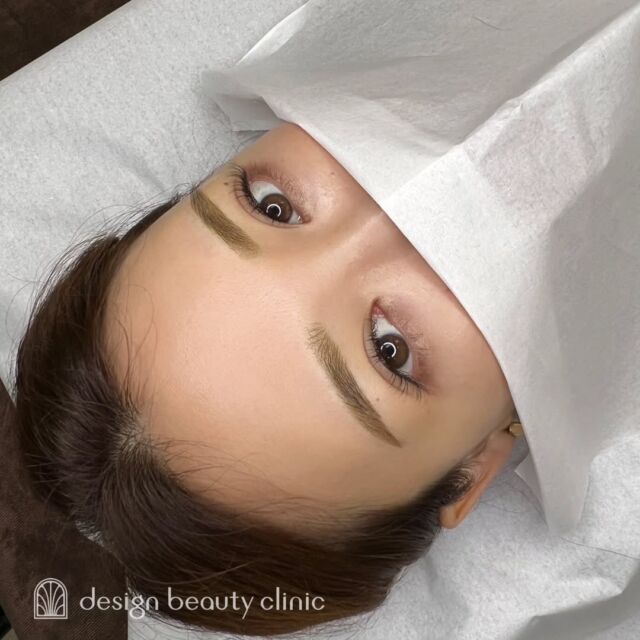 🪄
■お悩み・ご希望：
眉メイクを楽にしたいとご来院いただきました🫧
ゆるアーチの形がお好みとのことで
やわらかな印象のナチュラル眉を叶えました💎✨
■施術内容：
パウダー(2D)

お写真ご協力ありがとうございました☺️

➤施術名：アートメイク眉毛　1回33,000円（税込）
➤施術の説明：皮膚の浅い層を専用針で傷をつけて色素を入れることにより、皮膚を着色する施術です。
➤リスク・副作用：炎症症状(発赤・腫脹・熱感・疼痛)、内出血、痒み、アレルギー反応、感染等。

⚠️DMでのお問い合わせはお受けしておりません
お問い合わせは、クリニックへ直接お電話をお願いいたします🌱

････････････････････････････････････････

■医療機関名
デザイン ビューティー クリニック

■ご予約方法
•WEB／LINE（プロフィールからリンクできます）
•電話

■電話番号（問い合わせ・予約）
メニューによって電話番号が異なります。

🌿アートメイク（大阪）
　06-6616-8095

🌿美容皮膚科メニュー（大阪）
　06-6743-4652

🌿アートメイク（東京）
　03-6263-2519

■店舗紹介
アートメイクは下記の4院どこでもお受けいただけます。

🎀梅田エリアで通いやすい方はこちら🎀
🏥梅田本院
〒530-0013 大阪府大阪市北区茶屋町15-8
茶屋町ビル2階

営業時間：10:00～19:00
定休日：不定休
診療メニュー：美容皮膚科 / アートメイク

🏥アートメイク梅田院
〒530-0014 大阪府大阪市北区鶴野町2-1
梅田タナダビル１階

営業時間：10:00～19:00
定休日：不定休
診療メニュー： アートメイク

🎀 心斎橋・難波(なんば)エリアで通いやすい方はこちら 🎀
🏥アートメイク心斎橋院
〒542-0083 大阪市中央区東心斎橋1-20-14
心斎橋エルナ岩崎ビル5階

営業時間：10:00～19:00
定休日：不定休
診療メニュー： アートメイク

🎀 ついに東京エリアに開院！ご予約受付中 🎀
🏥アートメイク東京銀座院 (2025/12/1オープン)
〒104-0061 東京都中央区銀座1丁目28-16
SUGIURA GINZA 7階

営業時間：10:00～19:00
定休日：不定休
診療メニュー： アートメイク

････････････････････････････････････････

#アートメイク #美容クリニック #アートメイク眉 #アートメイクリップ #眉アート #アートメイク大阪 #アートメイク東京 #梅田 #心斎橋 #難波 #銀座