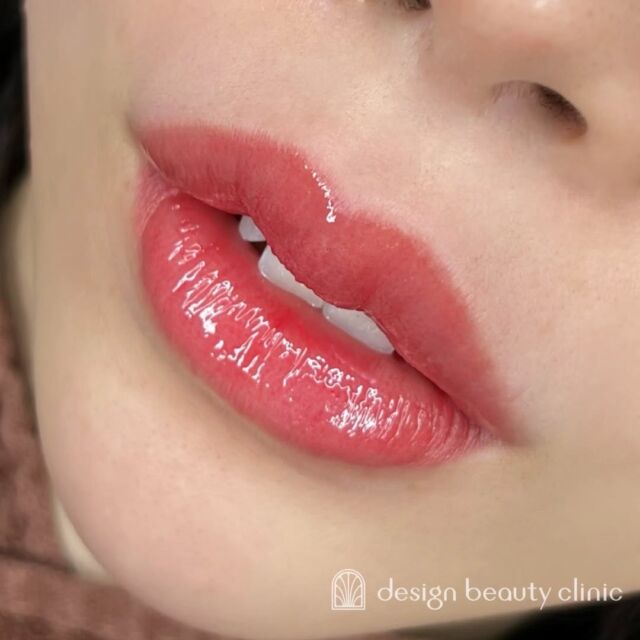 ■お悩み・ご希望：
くすみが気になる😖
1回目でくすみを飛ばし、2回目では理想のリップへ💖✨

■施術内容：
リップアートメイク

お写真ご協力ありがとうございました☺️

➤施術名：アートメイクリップ　1回44,000円（税込）
➤施術の説明：皮膚の浅い層を専用針で傷をつけて色素を入れることにより、皮膚を着色する施術です。
➤リスク・副作用：炎症症状(発赤・腫脹・熱感・疼痛)、内出血、痒み、アレルギー反応、感染等。

⚠️DMでのお問い合わせはお受けしておりません
お問い合わせは、クリニックへ直接お電話をお願いいたします🌱

････････････････････････････････････････

■医療機関名
デザイン ビューティー クリニック

■ご予約方法
•WEB／LINE（プロフィールからリンクできます）
•電話

■電話番号（問い合わせ・予約）
メニューによって電話番号が異なります。

🌿アートメイク（大阪）
　06-6616-8095

🌿美容皮膚科メニュー（大阪）
　06-6743-4652

🌿アートメイク（東京）
　03-6263-2519

■店舗紹介
アートメイクは下記の4院どこでもお受けいただけます。

🎀梅田エリアで通いやすい方はこちら🎀
🏥梅田本院
〒530-0013 大阪府大阪市北区茶屋町15-8
茶屋町ビル2階

営業時間：10:00～19:00
定休日：不定休
診療メニュー：美容皮膚科 / アートメイク

🏥アートメイク梅田院
〒530-0014 大阪府大阪市北区鶴野町2-1
梅田タナダビル１階

営業時間：10:00～19:00
定休日：不定休
診療メニュー： アートメイク

🎀 心斎橋・難波(なんば)エリアで通いやすい方はこちら 🎀
🏥アートメイク心斎橋院
〒542-0083 大阪市中央区東心斎橋1-20-14
心斎橋エルナ岩崎ビル5階

営業時間：10:00～19:00
定休日：不定休
診療メニュー： アートメイク

🎀 ついに東京エリアに開院！🎀
🏥アートメイク東京銀座院
〒104-0061 東京都中央区銀座1丁目28-16
SUGIURA GINZA 7階

営業時間：10:00～19:00
定休日：不定休
診療メニュー： アートメイク

････････････････････････････････････････
#アートメイク #アートメイク眉 #アートメイクリップ #アートメイク大阪 #アートメイク東京
