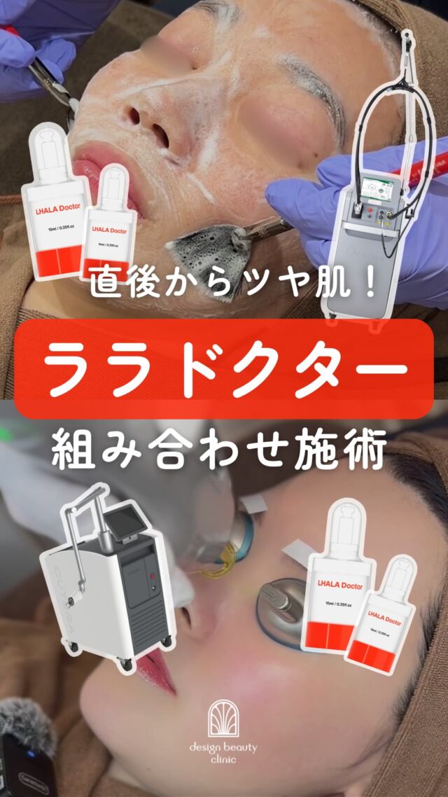 ツヤ肌を目指すなら✨さらに3月中はキャンペーン対象🉐

ララドクターは
ララピールを医療用に進化させた話題のピーリング🫧

角質ケアだけでなく
美容成分も配合されており
つるんとしたツヤ肌へ導きます✨

ダウンタイムも少なく
美容医療が初めての方にもおすすめです🌿

さらに仕上がりを求めるなら…
他施術との組み合わせ治療がオススメ✨

お肌のお悩みに合わせて
ぴったりの組み合わせをご提案いたします💭

＼3月限定キャンペーン／
今だけララドクター組み合わせ治療がおトク！

🫧 ララドクター＋ジェネシス(6000shot)
通常 ¥31,600 → ✨¥17,800✨

💎 ララドクター＋ピコトーニング
通常 ¥28,600 → ✨¥16,800✨

※税込価格
※3月平日限定／1回限り

まずはお気軽にご相談ください✨

⚠️DMでのお問い合わせはお受けしておりません
お問い合わせは、クリニックへ直接お電話をお願いいたします🌱

————————————

ACCESS：大阪府大阪市北区茶屋町15-8
茶屋町ビル2階
TEL：06-6743-4652
営業時間：10時〜17時
(最終受付時間：16時)
お問合せ受付時間：10時〜19時

#美容皮膚科 #美容クリニック #ララピール #ララドクター