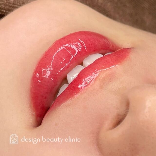 💋
■お悩み・ご希望：
2回目、半年ぶりのリタッチでご来院🌸
保湿だけで過ごせるようになり、やって良かったと💘
薄くなった部分をリタッチし、更に馴染みがよくなりました💋

■施術内容：
リップアートメイク

お写真ご協力ありがとうございました☺️

➤施術名：アートメイクリップ　1回44,000円（税込）
➤施術の説明：皮膚の浅い層を専用針で傷をつけて色素を入れることにより、皮膚を着色する施術です。
➤リスク・副作用：炎症症状(発赤・腫脹・熱感・疼痛)、内出血、痒み、アレルギー反応、感染等。

⚠️DMでのお問い合わせはお受けしておりません
お問い合わせは、クリニックへ直接お電話をお願いいたします🌱

････････････････････････････････････････

■医療機関名
デザイン ビューティー クリニック

■ご予約方法
•WEB／LINE（プロフィールからリンクできます）
•電話

■電話番号（問い合わせ・予約）
メニューによって電話番号が異なります。

🌿アートメイク（大阪）
　06-6616-8095

🌿美容皮膚科メニュー（大阪）
　06-6743-4652

🌿アートメイク（東京）
　03-6263-2519

■店舗紹介
アートメイクは下記の4院どこでもお受けいただけます。

🎀梅田エリアで通いやすい方はこちら🎀
🏥梅田本院
〒530-0013 大阪府大阪市北区茶屋町15-8
茶屋町ビル2階

営業時間：10:00～19:00
定休日：不定休
診療メニュー：美容皮膚科 / アートメイク

🏥アートメイク梅田院
〒530-0014 大阪府大阪市北区鶴野町2-1
梅田タナダビル１階

営業時間：10:00～19:00
定休日：不定休
診療メニュー： アートメイク

🎀 心斎橋・難波(なんば)エリアで通いやすい方はこちら 🎀
🏥アートメイク心斎橋院
〒542-0083 大阪市中央区東心斎橋1-20-14
心斎橋エルナ岩崎ビル5階

営業時間：10:00～19:00
定休日：不定休
診療メニュー： アートメイク

🎀 ついに東京エリアに開院！🎀
🏥アートメイク東京銀座院
〒104-0061 東京都中央区銀座1丁目28-16
SUGIURA GINZA 7階

営業時間：10:00～19:00
定休日：不定休
診療メニュー： アートメイク

････････････････････････････････････････
#アートメイク #アートメイク眉 #アートメイクリップ #アートメイク大阪 #アートメイク東京