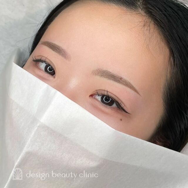 🪄
■お悩み・ご希望：
毎日のメイクを楽にしたい。
ベースはメイク感のでるパウダー、眉頭の無料が足りない部分に毛並みで仕上げました。

■施術内容：
パウダー（2D）
（眉頭のみ毛並み）

お写真ご協力ありがとうございました🕊️

➤施術名：アートメイク眉毛　1回33,000円（税込）
➤施術の説明：皮膚の浅い層を専用針で傷をつけて色素を入れることにより、皮膚を着色する施術です。
➤リスク・副作用：炎症症状(発赤・腫脹・熱感・疼痛)、内出血、痒み、アレルギー反応、感染等。

⚠️DMでのお問い合わせはお受けしておりません
お問い合わせは、クリニックへ直接お電話をお願いいたします

‥‥‥‥‥‥‥‥‥‥‥‥‥‥‥‥‥‥‥‥

■医療機関名
デザイン ビューティー クリニック

■ご予約方法
•WEB／LINE（プロフィールからリンクできます）
•電話

■電話番号（問い合わせ・予約）
メニューによって電話番号が異なります。

🌿アートメイク（大阪）
　06-6616-8095

🌿美容皮膚科メニュー（大阪）
　06-6743-4652

🌿アートメイク（東京）
　03-6263-2519

■店舗紹介
アートメイクは下記の4院どこでもお受けいただけます。

─ 梅田エリア ─

📍 梅田本院
大阪府大阪市北区茶屋町15-8 茶屋町ビル2階
営業時間：10:00〜19:00 ／ 定休日：不定休
診療：美容皮膚科 / アートメイク

📍 アートメイク梅田院
大阪府大阪市北区鶴野町2-1 梅田タナダビル1階
営業時間：10:00〜19:00 ／ 定休日：不定休
診療：アートメイク

─ 心斎橋・難波エリア ─

📍 アートメイク心斎橋院
大阪市中央区東心斎橋1-20-14 心斎橋エルナ岩崎ビル5階
営業時間：10:00〜19:00 ／ 定休日：不定休
診療：アートメイク

─ 東京エリア ─

📍アートメイク東京銀座院
東京都中央区銀座1丁目28-16 SUGIURA GINZA 7階
営業時間：10:00〜19:00 ／ 定休日：不定休
診療：アートメイク

‥‥‥‥‥‥‥‥‥‥‥‥‥‥‥‥‥‥‥‥
#アートメイク #アートメイク眉 #アートメイクリップ #アートメイク大阪 #アートメイク東京