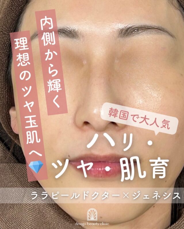 .
✨ララドクター × ジェネシス✨

「肌質改善も透明感も欲しい！」
そんな方におすすめの組み合わせ治療です💎

🌿ララドクター
LHA（脂溶性サリチル酸）を配合したピーリングで、古い角質や毛穴汚れをやさしく除去✨
肌への負担を抑えながら、なめらかでツヤのあるお肌へ導きます。

🌟ジェネシス
レーザーをマイルドに照射し、肌のハリ・キメ・赤み・毛穴にアプローチ✨
コラーゲン生成を促し、内側からふっくらとした肌を目指します。

この2つを組み合わせることで、
✔ 毛穴の開き
✔ 肌のざらつき
✔ くすみ
✔ 赤み
✔ ハリ不足

など、複数のお悩みに同時にアプローチ💕

ララドクターで不要な角質を整えた後にジェネシスを行うことで、よりなめらかでツヤ感のある美肌を目指せます✨

ダウンタイムが少なく、美容医療が初めての方にも人気の組み合わせです🌷

一人ひとりのお肌状態に合わせてご提案いたしますので、お気軽にご相談ください😊

【ララドクター】
■初回：7,700円（税込）
■通常：12,800円（税込）
■3回コース：23,100円（税込）

【ジェネシス】
■初回3000shot：7,800円（税込）
■通常3000shot：10,800円（税込）
■初回6000shot：13,600円（税込）
■通常6000shot：18,800円（税込）

⚠️DMでのお問い合わせはお受けしておりません
お問い合わせは、クリニックへ直接お電話をお願いいたします🌱

————————————

ACCESS：大阪府大阪市北区茶屋町15-8
茶屋町ビル2階
TEL：06-6743-4652
営業時間：10時〜17時
(最終受付時間：16時)
お問合せ受付時間：10時〜19時

#美容皮膚科 #美容外科 #美容クリニック #ジェネシス #ララドクター