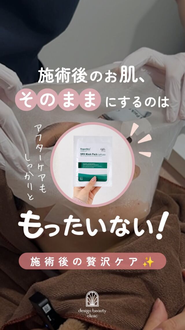 🪞
施術後のお肌、そのままにするのはもったいない👀
いつもの施術後にプラスしてみてほしい、人気の施術後ケア！

実は施術直後って、肌が成分を
いちばん吸収しやすいタイミングなんです✨

当院で人気の施術後ケアが
SRSマスクとエレクトロポレーション（導入保湿）

🌿 SRSマスク
施術後の赤みや敏感になった肌を
やさしく鎮静してくれます。

💧エレクトロポレーション
ツヤ感・保湿をプラスしたい方に✨
施術後は肌のバリアが一時的に緩んでいるので
うるおい成分が奥までぐんと浸透します。

どちらも施術後のダウンタイムをやわらげながら
効果をしっかり引き出してくれるケアです💆‍♀️✨

気になる方はお気軽にスタッフまでお声掛けください🌷

🌿 リジェンスキン SRSマスクパック
2,200円（1枚）

💧エレクトロポレーション（全顔）
初回：5,500円
通常：6,600円
3回コース：16,500円（1回あたり5,500円）
10回コース：49,500円（1回あたり4,950円）

〈薬剤追加オプション〉
ニキビ/美白/エイジング：各3,300円
ベビースキン：9,800円

※全て税込み価格

ご予約はLINE予約・WEB予約・お電話にて受け付けております🌷
カウンセリング無料、美容ナースがあなたのお悩みに寄り添います。

⚠️DMでのお問い合わせはお受けしておりません
お問い合わせは、クリニックへ直接お電話をお願いいたします🌱

————————————

ACCESS：大阪府大阪市北区茶屋町15-8
茶屋町ビル2階
TEL：06-6743-4652
営業時間：10時〜19時

#美容皮膚科 #美容クリニック #デザインビューティークリニック #リジェンスキンマスク #美肌