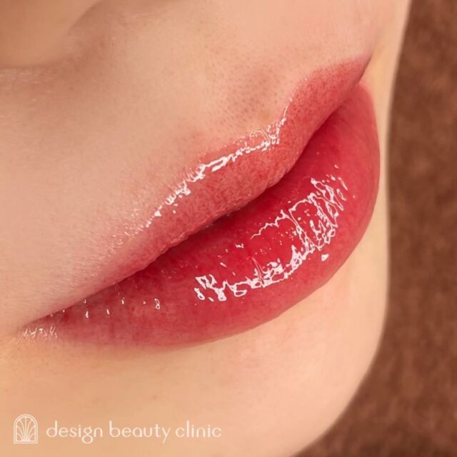 💋
■お悩み・ご希望：
・お悩み：口紅の塗り直しが面倒
・ご希望：血色感をアップさせたいとのことでリップアート初挑戦

■施術内容：
リップアートメイク

お写真ご協力ありがとうございました🕊️

➤施術名：アートメイクリップ　1回44,000円（税込）
➤施術の説明：皮膚の浅い層を専用針で傷をつけて色素を入れることにより、皮膚を着色する施術です。
➤リスク・副作用：炎症症状(発赤・腫脹・熱感・疼痛)、内出血、痒み、アレルギー反応、感染等。

⚠️DMでのお問い合わせはお受けしておりません
お問い合わせは、クリニックへ直接お電話をお願いいたします

‥‥‥‥‥‥‥‥‥‥‥‥‥‥‥‥‥‥‥‥

■医療機関名
デザイン ビューティー クリニック

■ご予約方法
•WEB／LINE（プロフィールからリンクできます）
•電話

■電話番号（問い合わせ・予約）
メニューによって電話番号が異なります。

🌿アートメイク（大阪）
　06-6616-8095

🌿美容皮膚科メニュー（大阪）
　06-6743-4652

🌿アートメイク（東京）
　03-6263-2519

■店舗紹介
アートメイクは下記の4院どこでもお受けいただけます。

─ 梅田エリア ─

📍 梅田本院
大阪府大阪市北区茶屋町15-8 茶屋町ビル2階
営業時間：10:00〜19:00 ／ 定休日：不定休
診療：美容皮膚科 / アートメイク

📍 アートメイク梅田院
大阪府大阪市北区鶴野町2-1 梅田タナダビル1階
営業時間：10:00〜19:00 ／ 定休日：不定休
診療：アートメイク

─ 心斎橋・難波エリア ─

📍 アートメイク心斎橋院
大阪市中央区東心斎橋1-20-14 心斎橋エルナ岩崎ビル5階
営業時間：10:00〜19:00 ／ 定休日：不定休
診療：アートメイク

─ 東京エリア ─

📍アートメイク東京銀座院
東京都中央区銀座1丁目28-16 SUGIURA GINZA 7階
営業時間：10:00〜19:00 ／ 定休日：不定休
診療：アートメイク

‥‥‥‥‥‥‥‥‥‥‥‥‥‥‥‥‥‥‥‥
#アートメイク #アートメイク眉 #アートメイクリップ #アートメイク大阪 #アートメイク東京