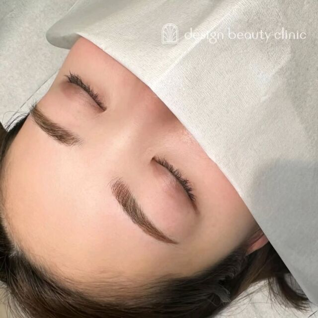 🪄
■お悩み・ご希望：
ご希望：眉尻がしっかり欲しい

■施術内容：
パウダー(2D)

お写真ご協力ありがとうございました🕊️

➤施術名：アートメイク眉毛　1回33,000円（税込）
➤施術の説明：皮膚の浅い層を専用針で傷をつけて色素を入れることにより、皮膚を着色する施術です。
➤リスク・副作用：炎症症状(発赤・腫脹・熱感・疼痛)、内出血、痒み、アレルギー反応、感染等。

⚠️DMでのお問い合わせはお受けしておりません
お問い合わせは、クリニックへ直接お電話をお願いいたします

‥‥‥‥‥‥‥‥‥‥‥‥‥‥‥‥‥‥‥‥

■医療機関名
デザイン ビューティー クリニック

■ご予約方法
•WEB／LINE（プロフィールからリンクできます）
•電話

■電話番号（問い合わせ・予約）
メニューによって電話番号が異なります。

🌿アートメイク（大阪）
　06-6616-8095

🌿美容皮膚科メニュー（大阪）
　06-6743-4652

🌿アートメイク（東京）
　03-6263-2519

■店舗紹介
アートメイクは下記の4院どこでもお受けいただけます。

─ 梅田エリア ─

📍 梅田本院
大阪府大阪市北区茶屋町15-8 茶屋町ビル2階
営業時間：10:00〜19:00 ／ 定休日：不定休
診療：美容皮膚科 / アートメイク

📍 アートメイク梅田院
大阪府大阪市北区鶴野町2-1 梅田タナダビル1階
営業時間：10:00〜19:00 ／ 定休日：不定休
診療：アートメイク

─ 心斎橋・難波エリア ─

📍 アートメイク心斎橋院
大阪市中央区東心斎橋1-20-14 心斎橋エルナ岩崎ビル5階
営業時間：10:00〜19:00 ／ 定休日：不定休
診療：アートメイク

─ 東京エリア ─

📍アートメイク東京銀座院
東京都中央区銀座1丁目28-16 SUGIURA GINZA 7階
営業時間：10:00〜19:00 ／ 定休日：不定休
診療：アートメイク

‥‥‥‥‥‥‥‥‥‥‥‥‥‥‥‥‥‥‥‥
#アートメイク #アートメイク眉 #アートメイクリップ #アートメイク大阪 #アートメイク東京
