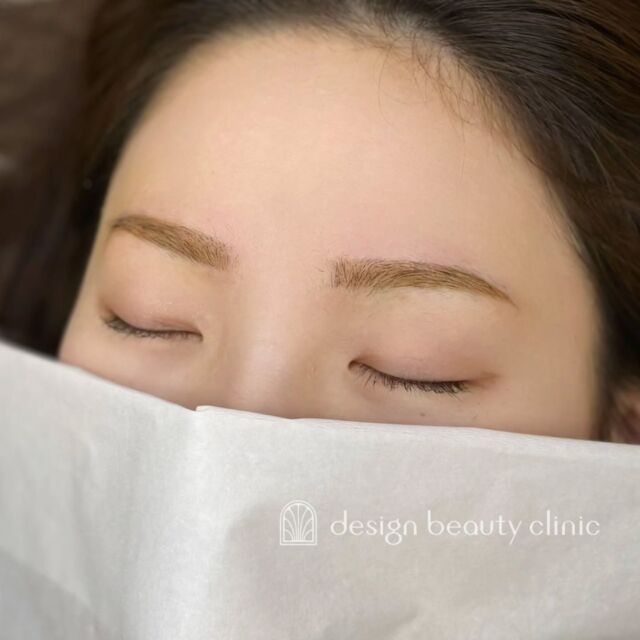 🪄
■お悩み・ご希望：
お悩み：まばら感を整えたい
ご希望：左眉尻の眉毛が欲しい

■施術内容：
パウダー(2D)

お写真ご協力ありがとうございました🕊️

➤施術名：アートメイク眉毛　1回33,000円（税込）
➤施術の説明：皮膚の浅い層を専用針で傷をつけて色素を入れることにより、皮膚を着色する施術です。
➤リスク・副作用：炎症症状(発赤・腫脹・熱感・疼痛)、内出血、痒み、アレルギー反応、感染等。

⚠️DMでのお問い合わせはお受けしておりません
お問い合わせは、クリニックへ直接お電話をお願いいたします

‥‥‥‥‥‥‥‥‥‥‥‥‥‥‥‥‥‥‥‥

■医療機関名
デザイン ビューティー クリニック

■ご予約方法
•WEB／LINE（プロフィールからリンクできます）
•電話

■電話番号（問い合わせ・予約）
地域・メニューによって電話番号が異なります。

🌿大阪 アートメイク
　06-6616-8095

🌿東京 アートメイク
　03-6263-2519

🌿名古屋 アートメイク
　052-433-7730

🌿大阪 美容皮膚科
　06-6743-4652

■店舗紹介
アートメイクは下記の5院どこでもお受けいただけます。

─ 梅田エリア ─

📍 梅田本院
大阪府大阪市北区茶屋町15-8 茶屋町ビル2階
営業時間：10:00〜19:00 ／ 定休日：不定休
診療：アートメイク / 美容皮膚科

📍 アートメイク梅田院
大阪府大阪市北区鶴野町2-1 梅田タナダビル1階
営業時間：10:00〜19:00 ／ 定休日：不定休
診療：アートメイク

─ 心斎橋・難波エリア ─

📍 アートメイク心斎橋院
大阪市中央区東心斎橋1-20-14 心斎橋エルナ岩崎ビル5階
営業時間：10:00〜19:00 ／ 定休日：不定休
診療：アートメイク

─ 東京エリア ─

📍アートメイク東京銀座院
東京都中央区銀座1丁目28-16 SUGIURA GINZA 7階
営業時間：10:00〜19:00 ／ 定休日：不定休
診療：アートメイク

─ 愛知エリア ─

📍アートメイク名古屋院
愛知県名古屋市西区名駅3-10-15 名駅三丁目ビル2階
営業時間：10:00〜19:00 ／ 定休日：不定休
診療：アートメイク

‥‥‥‥‥‥‥‥‥‥‥‥‥‥‥‥‥‥‥‥
#アートメイク #アートメイク眉 #アートメイクリップ #アートメイク大阪 #アートメイク東京