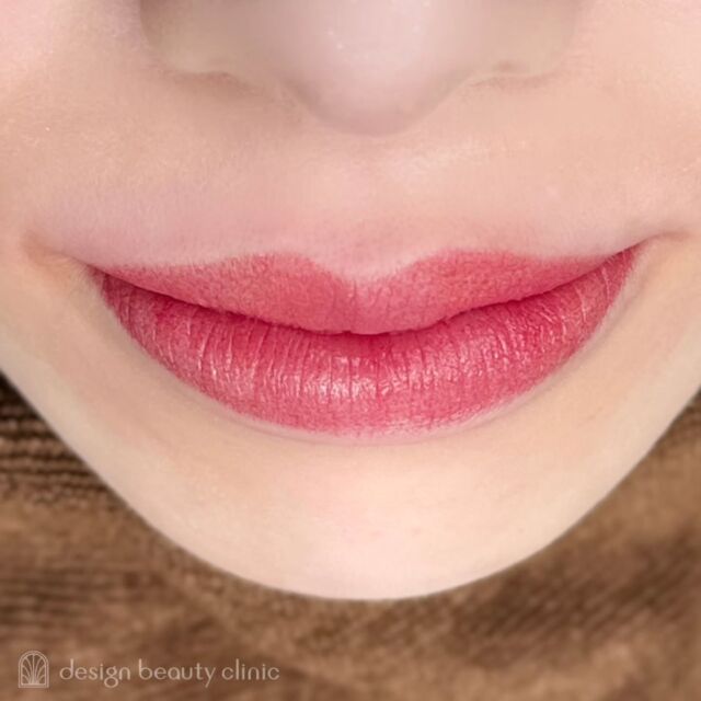 💋
■お悩み・ご希望：
お悩み：全体的に色が薄い
ご希望：濃いめ

■施術内容：
リップアートメイク

お写真ご協力ありがとうございました🕊️

➤施術名：アートメイクリップ　1回44,000円（税込）
➤施術の説明：皮膚の浅い層を専用針で傷をつけて色素を入れることにより、皮膚を着色する施術です。
➤リスク・副作用：炎症症状(発赤・腫脹・熱感・疼痛)、内出血、痒み、アレルギー反応、感染等。

⚠️DMでのお問い合わせはお受けしておりません
お問い合わせは、クリニックへ直接お電話をお願いいたします

‥‥‥‥‥‥‥‥‥‥‥‥‥‥‥‥‥‥‥‥

■医療機関名
デザイン ビューティー クリニック

■ご予約方法
•WEB／LINE（プロフィールからリンクできます）
•電話

■電話番号（問い合わせ・予約）
地域・メニューによって電話番号が異なります。

🌿大阪 アートメイク
　06-6616-8095

🌿東京 アートメイク
　03-6263-2519

🌿名古屋 アートメイク
　052-433-7730

🌿大阪 美容皮膚科
　06-6743-4652

■店舗紹介
アートメイクは下記の5院どこでもお受けいただけます。

─ 梅田エリア ─

📍 梅田本院
大阪府大阪市北区茶屋町15-8 茶屋町ビル2階
営業時間：10:00〜19:00 ／ 定休日：不定休
診療：アートメイク / 美容皮膚科

📍 アートメイク梅田院
大阪府大阪市北区鶴野町2-1 梅田タナダビル1階
営業時間：10:00〜19:00 ／ 定休日：不定休
診療：アートメイク

─ 心斎橋・難波エリア ─

📍 アートメイク心斎橋院
大阪市中央区東心斎橋1-20-14 心斎橋エルナ岩崎ビル5階
営業時間：10:00〜19:00 ／ 定休日：不定休
診療：アートメイク

─ 東京エリア ─

📍アートメイク東京銀座院
東京都中央区銀座1丁目28-16 SUGIURA GINZA 7階
営業時間：10:00〜19:00 ／ 定休日：不定休
診療：アートメイク

─ 愛知エリア ─

📍アートメイク名古屋院
愛知県名古屋市西区名駅3-10-15 名駅三丁目ビル2階
営業時間：10:00〜19:00 ／ 定休日：不定休
診療：アートメイク

‥‥‥‥‥‥‥‥‥‥‥‥‥‥‥‥‥‥‥‥
#アートメイク #アートメイク眉 #アートメイクリップ #アートメイク大阪 #アートメイク東京