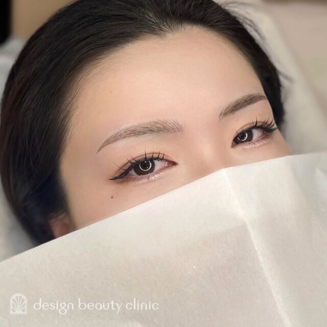 🪄
■お悩み・ご希望：
ご希望：アーチ眉がよい

■施術内容：
毛並み+パウダー(4D)

お写真ご協力ありがとうございました🕊️

➤施術名：アートメイク眉毛　1回33,000円（税込）
➤施術の説明：皮膚の浅い層を専用針で傷をつけて色素を入れることにより、皮膚を着色する施術です。
➤リスク・副作用：炎症症状(発赤・腫脹・熱感・疼痛)、内出血、痒み、アレルギー反応、感染等。

⚠️DMでのお問い合わせはお受けしておりません
お問い合わせは、クリニックへ直接お電話をお願いいたします

‥‥‥‥‥‥‥‥‥‥‥‥‥‥‥‥‥‥‥‥

■医療機関名
デザイン ビューティー クリニック

■ご予約方法
•WEB／LINE（プロフィールからリンクできます）
•電話

■電話番号（問い合わせ・予約）
地域・メニューによって電話番号が異なります。

🌿大阪 アートメイク
　06-6616-8095

🌿東京 アートメイク
　03-6263-2519

🌿名古屋 アートメイク
　052-433-7730

🌿大阪 美容皮膚科
　06-6743-4652

■店舗紹介
アートメイクは下記の5院どこでもお受けいただけます。

─ 梅田エリア ─

📍 梅田本院
大阪府大阪市北区茶屋町15-8 茶屋町ビル2階
営業時間：10:00〜19:00 ／ 定休日：不定休
診療：アートメイク / 美容皮膚科

📍 アートメイク梅田院
大阪府大阪市北区鶴野町2-1 梅田タナダビル1階
営業時間：10:00〜19:00 ／ 定休日：不定休
診療：アートメイク

─ 心斎橋・難波エリア ─

📍 アートメイク心斎橋院
大阪市中央区東心斎橋1-20-14 心斎橋エルナ岩崎ビル5階
営業時間：10:00〜19:00 ／ 定休日：不定休
診療：アートメイク

─ 東京エリア ─

📍アートメイク東京銀座院
東京都中央区銀座1丁目28-16 SUGIURA GINZA 7階
営業時間：10:00〜19:00 ／ 定休日：不定休
診療：アートメイク

─ 愛知エリア ─

📍アートメイク名古屋院
愛知県名古屋市西区名駅3-10-15 名駅三丁目ビル2階
営業時間：10:00〜19:00 ／ 定休日：不定休
診療：アートメイク

‥‥‥‥‥‥‥‥‥‥‥‥‥‥‥‥‥‥‥‥
#アートメイク #アートメイク眉 #アートメイクリップ #アートメイク大阪 #アートメイク東京