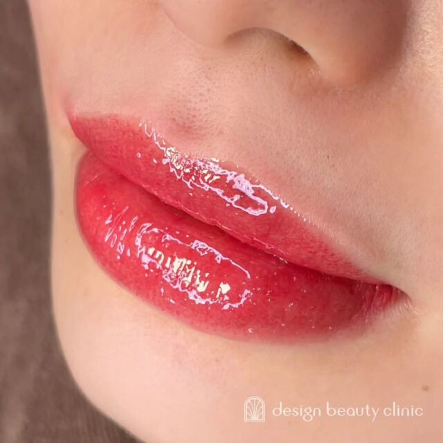 💋
■お悩み・ご希望：
１回目で自然に血色感アップしておりベースが整ったので、今回は濃さを出して調整しました。

■施術内容：
リップアートメイク

お写真ご協力ありがとうございました🕊️

➤施術名：アートメイクリップ　1回44,000円（税込）
➤施術の説明：皮膚の浅い層を専用針で傷をつけて色素を入れることにより、皮膚を着色する施術です。
➤リスク・副作用：炎症症状(発赤・腫脹・熱感・疼痛)、内出血、痒み、アレルギー反応、感染等。

⚠️DMでのお問い合わせはお受けしておりません
お問い合わせは、クリニックへ直接お電話をお願いいたします

‥‥‥‥‥‥‥‥‥‥‥‥‥‥‥‥‥‥‥‥

■医療機関名
デザイン ビューティー クリニック

■ご予約方法
•WEB／LINE（プロフィールからリンクできます）
•電話

■電話番号（問い合わせ・予約）
メニューによって電話番号が異なります。

🌿アートメイク（大阪）
　06-6616-8095

🌿美容皮膚科メニュー（大阪）
　06-6743-4652

🌿アートメイク（東京）
　03-6263-2519

■店舗紹介
アートメイクは下記の4院どこでもお受けいただけます。

─ 梅田エリア ─

📍 梅田本院
大阪府大阪市北区茶屋町15-8 茶屋町ビル2階
営業時間：10:00〜19:00 ／ 定休日：不定休
診療：美容皮膚科 / アートメイク

📍 アートメイク梅田院
大阪府大阪市北区鶴野町2-1 梅田タナダビル1階
営業時間：10:00〜19:00 ／ 定休日：不定休
診療：アートメイク

─ 心斎橋・難波エリア ─

📍 アートメイク心斎橋院
大阪市中央区東心斎橋1-20-14 心斎橋エルナ岩崎ビル5階
営業時間：10:00〜19:00 ／ 定休日：不定休
診療：アートメイク

─ 東京エリア ─

📍アートメイク東京銀座院
東京都中央区銀座1丁目28-16 SUGIURA GINZA 7階
営業時間：10:00〜19:00 ／ 定休日：不定休
診療：アートメイク

‥‥‥‥‥‥‥‥‥‥‥‥‥‥‥‥‥‥‥‥
#アートメイク #アートメイク眉 #アートメイクリップ #アートメイク大阪 #アートメイク東京