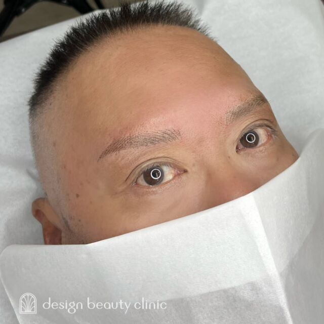 🪄
■お悩み・ご希望：
お悩み：自眉が少ない

■施術内容：
毛並み+パウダー(4D)

お写真ご協力ありがとうございました🕊️

➤施術名：アートメイク眉毛　1回33,000円（税込）
➤施術の説明：皮膚の浅い層を専用針で傷をつけて色素を入れることにより、皮膚を着色する施術です。
➤リスク・副作用：炎症症状(発赤・腫脹・熱感・疼痛)、内出血、痒み、アレルギー反応、感染等。

⚠️DMでのお問い合わせはお受けしておりません
お問い合わせは、クリニックへ直接お電話をお願いいたします

‥‥‥‥‥‥‥‥‥‥‥‥‥‥‥‥‥‥‥‥

■医療機関名
デザイン ビューティー クリニック

■ご予約方法
•WEB／LINE（プロフィールからリンクできます）
•電話

■電話番号（問い合わせ・予約）
地域・メニューによって電話番号が異なります。

🌿大阪 アートメイク
　06-6616-8095

🌿東京 アートメイク
　03-6263-2519

🌿名古屋 アートメイク
　052-433-7730

🌿大阪 美容皮膚科
　06-6743-4652

■店舗紹介
アートメイクは下記の5院どこでもお受けいただけます。

─ 梅田エリア ─

📍 梅田本院
大阪府大阪市北区茶屋町15-8 茶屋町ビル2階
営業時間：10:00〜19:00 ／ 定休日：不定休
診療：アートメイク / 美容皮膚科

📍 アートメイク梅田院
大阪府大阪市北区鶴野町2-1 梅田タナダビル1階
営業時間：10:00〜19:00 ／ 定休日：不定休
診療：アートメイク

─ 心斎橋・難波エリア ─

📍 アートメイク心斎橋院
大阪市中央区東心斎橋1-20-14 心斎橋エルナ岩崎ビル5階
営業時間：10:00〜19:00 ／ 定休日：不定休
診療：アートメイク

─ 東京エリア ─

📍アートメイク東京銀座院
東京都中央区銀座1丁目28-16 SUGIURA GINZA 7階
営業時間：10:00〜19:00 ／ 定休日：不定休
診療：アートメイク

─ 愛知エリア ─

📍アートメイク名古屋院
愛知県名古屋市西区名駅3-10-15 名駅三丁目ビル2階
営業時間：10:00〜19:00 ／ 定休日：不定休
診療：アートメイク

‥‥‥‥‥‥‥‥‥‥‥‥‥‥‥‥‥‥‥‥
#アートメイク #アートメイク眉 #アートメイクリップ #アートメイク大阪 #アートメイク東京