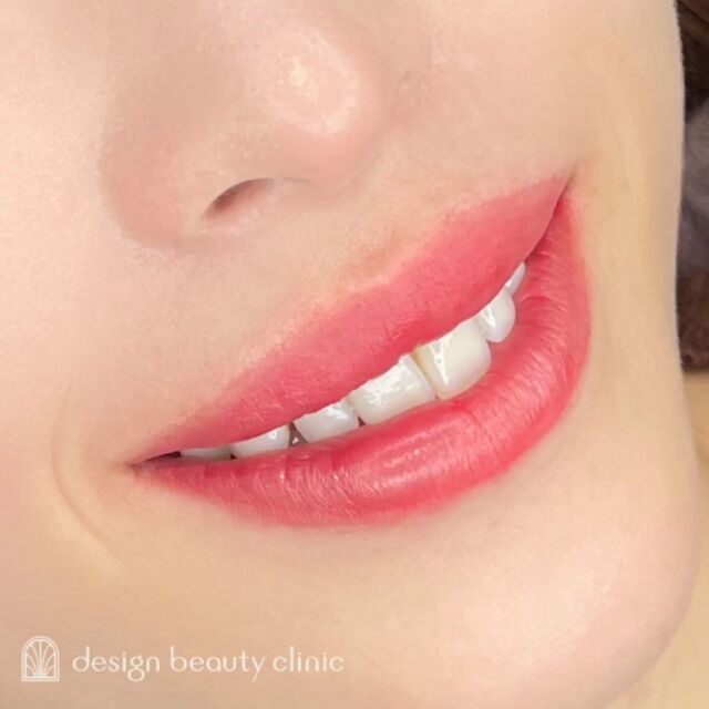 💋
■お悩み・ご希望：
お悩み：血色がない
ご希望：メイクを楽にしたい

■施術内容：
リップアートメイク

お写真ご協力ありがとうございました🕊️

➤施術名：アートメイクリップ　1回44,000円（税込）
➤施術の説明：皮膚の浅い層を専用針で傷をつけて色素を入れることにより、皮膚を着色する施術です。
➤リスク・副作用：炎症症状(発赤・腫脹・熱感・疼痛)、内出血、痒み、アレルギー反応、感染等。

⚠️DMでのお問い合わせはお受けしておりません
お問い合わせは、クリニックへ直接お電話をお願いいたします

‥‥‥‥‥‥‥‥‥‥‥‥‥‥‥‥‥‥‥‥

■医療機関名
デザイン ビューティー クリニック

■ご予約方法
•WEB／LINE（プロフィールからリンクできます）
•電話

■電話番号（問い合わせ・予約）
地域・メニューによって電話番号が異なります。

🌿大阪 アートメイク
　06-6616-8095

🌿東京 アートメイク
　03-6263-2519

🌿名古屋 アートメイク
　052-433-7730

🌿大阪 美容皮膚科
　06-6743-4652

■店舗紹介
アートメイクは下記の5院どこでもお受けいただけます。

─ 梅田エリア ─

📍 梅田本院
大阪府大阪市北区茶屋町15-8 茶屋町ビル2階
営業時間：10:00〜19:00 ／ 定休日：不定休
診療：アートメイク / 美容皮膚科

📍 アートメイク梅田院
大阪府大阪市北区鶴野町2-1 梅田タナダビル1階
営業時間：10:00〜19:00 ／ 定休日：不定休
診療：アートメイク

─ 心斎橋・難波エリア ─

📍 アートメイク心斎橋院
大阪市中央区東心斎橋1-20-14 心斎橋エルナ岩崎ビル5階
営業時間：10:00〜19:00 ／ 定休日：不定休
診療：アートメイク

─ 東京エリア ─

📍アートメイク東京銀座院
東京都中央区銀座1丁目28-16 SUGIURA GINZA 7階
営業時間：10:00〜19:00 ／ 定休日：不定休
診療：アートメイク

─ 愛知エリア ─

📍アートメイク名古屋院
愛知県名古屋市西区名駅3-10-15 名駅三丁目ビル2階
営業時間：10:00〜19:00 ／ 定休日：不定休
診療：アートメイク

‥‥‥‥‥‥‥‥‥‥‥‥‥‥‥‥‥‥‥‥
#アートメイク #アートメイク眉 #アートメイクリップ #アートメイク大阪 #アートメイク東京