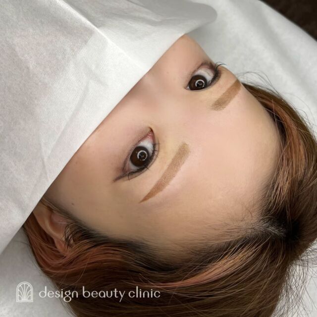 🪄
■お悩み・ご希望：
お悩み：眉毛がない
ご希望：眉メイクを楽にしたい

■施術内容：
パウダー(2D)

お写真ご協力ありがとうございました🕊️

➤施術名：アートメイク眉毛　1回33,000円（税込）
➤施術の説明：皮膚の浅い層を専用針で傷をつけて色素を入れることにより、皮膚を着色する施術です。
➤リスク・副作用：炎症症状(発赤・腫脹・熱感・疼痛)、内出血、痒み、アレルギー反応、感染等。

⚠️DMでのお問い合わせはお受けしておりません
お問い合わせは、クリニックへ直接お電話をお願いいたします

‥‥‥‥‥‥‥‥‥‥‥‥‥‥‥‥‥‥‥‥

■医療機関名
デザイン ビューティー クリニック

■ご予約方法
•WEB／LINE（プロフィールからリンクできます）
•電話

■電話番号（問い合わせ・予約）
地域・メニューによって電話番号が異なります。

🌿大阪 アートメイク
　06-6616-8095

🌿東京 アートメイク
　03-6263-2519

🌿名古屋 アートメイク
　052-433-7730

🌿大阪 美容皮膚科
　06-6743-4652

■店舗紹介
アートメイクは下記の5院どこでもお受けいただけます。

─ 梅田エリア ─

📍 梅田本院
大阪府大阪市北区茶屋町15-8 茶屋町ビル2階
営業時間：10:00〜19:00 ／ 定休日：不定休
診療：アートメイク / 美容皮膚科

📍 アートメイク梅田院
大阪府大阪市北区鶴野町2-1 梅田タナダビル1階
営業時間：10:00〜19:00 ／ 定休日：不定休
診療：アートメイク

─ 心斎橋・難波エリア ─

📍 アートメイク心斎橋院
大阪市中央区東心斎橋1-20-14 心斎橋エルナ岩崎ビル5階
営業時間：10:00〜19:00 ／ 定休日：不定休
診療：アートメイク

─ 東京エリア ─

📍アートメイク東京銀座院
東京都中央区銀座1丁目28-16 SUGIURA GINZA 7階
営業時間：10:00〜19:00 ／ 定休日：不定休
診療：アートメイク

─ 愛知エリア ─

📍アートメイク名古屋院
愛知県名古屋市西区名駅3-10-15 名駅三丁目ビル2階
営業時間：10:00〜19:00 ／ 定休日：不定休
診療：アートメイク

‥‥‥‥‥‥‥‥‥‥‥‥‥‥‥‥‥‥‥‥
#アートメイク #アートメイク眉 #アートメイクリップ #アートメイク大阪 #アートメイク東京