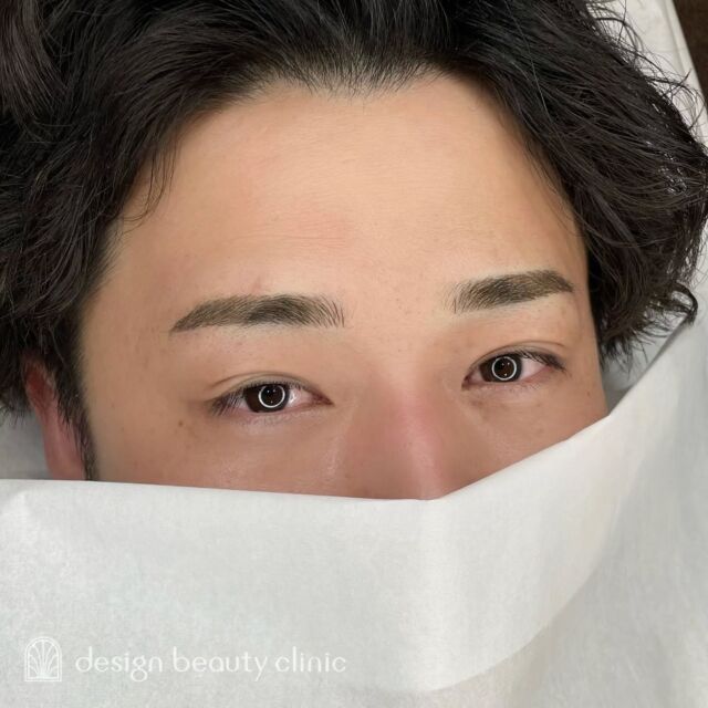 🪄
■お悩み・ご希望：
ご希望：顔立ちがよりハッキリして見えるよう、キリっとした印象の眉にしたい

■施術内容：
毛並み+パウダー(4D)

お写真ご協力ありがとうございました🕊️

➤施術名：アートメイク眉毛　1回33,000円（税込）
➤施術の説明：皮膚の浅い層を専用針で傷をつけて色素を入れることにより、皮膚を着色する施術です。
➤リスク・副作用：炎症症状(発赤・腫脹・熱感・疼痛)、内出血、痒み、アレルギー反応、感染等。

⚠️DMでのお問い合わせはお受けしておりません
お問い合わせは、クリニックへ直接お電話をお願いいたします

‥‥‥‥‥‥‥‥‥‥‥‥‥‥‥‥‥‥‥‥

■医療機関名
デザイン ビューティー クリニック

■ご予約方法
•WEB／LINE（プロフィールからリンクできます）
•電話

■電話番号（問い合わせ・予約）
地域・メニューによって電話番号が異なります。

🌿大阪 アートメイク
　06-6616-8095

🌿東京 アートメイク
　03-6263-2519

🌿名古屋 アートメイク
　052-433-7730

🌿大阪 美容皮膚科
　06-6743-4652

■店舗紹介
アートメイクは下記の5院どこでもお受けいただけます。

─ 梅田エリア ─

📍 梅田本院
大阪府大阪市北区茶屋町15-8 茶屋町ビル2階
営業時間：10:00〜19:00 ／ 定休日：不定休
診療：アートメイク / 美容皮膚科

📍 アートメイク梅田院
大阪府大阪市北区鶴野町2-1 梅田タナダビル1階
営業時間：10:00〜19:00 ／ 定休日：不定休
診療：アートメイク

─ 心斎橋・難波エリア ─

📍 アートメイク心斎橋院
大阪市中央区東心斎橋1-20-14 心斎橋エルナ岩崎ビル5階
営業時間：10:00〜19:00 ／ 定休日：不定休
診療：アートメイク

─ 東京エリア ─

📍アートメイク東京銀座院
東京都中央区銀座1丁目28-16 SUGIURA GINZA 7階
営業時間：10:00〜19:00 ／ 定休日：不定休
診療：アートメイク

─ 愛知エリア ─

📍アートメイク名古屋院
愛知県名古屋市西区名駅3-10-15 名駅三丁目ビル2階
営業時間：10:00〜19:00 ／ 定休日：不定休
診療：アートメイク

‥‥‥‥‥‥‥‥‥‥‥‥‥‥‥‥‥‥‥‥
#アートメイク #アートメイク眉 #アートメイクリップ #アートメイク大阪 #アートメイク東京