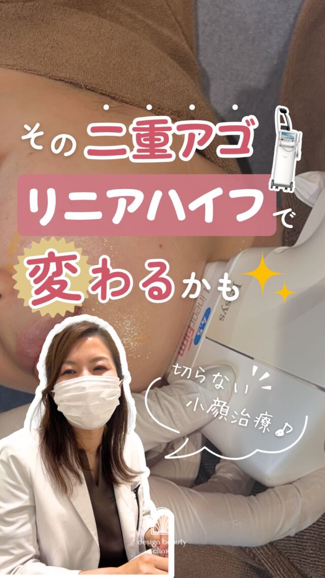 🤍
＼その"二重アゴ"、あきらめていませんか?🥲／

ふと下を向いた時の顔、
写真に撮られる角度、鏡でよく見る瞬間…

「あれ、顎下もたついてるかも」って
気づいたことありませんか?👀

実はそのもたつき、
リニアハイフ(アゴ下)でアプローチできるかもしれません✨

🌿 リニアハイフとは
超音波の熱エネルギーを脂肪層に届けて
引き締めていく施術です。

切らない・ダウンタイムを抑えながら
アプローチできるのも嬉しいポイント🪞

✨今だけキャンペーン開催中✨
💎 リニアハイフ（アゴ下）
100shot
通常:¥11,000

300shot✨キャンペーン
通常:¥33,000 → ¥19,800

400shot✨キャンペーン
通常:¥44,000 → ¥29,800

※全て税込み価格
※～2026年9月30日まで/1回限り

今月は小顔治療強化月間！
他の小顔治療もキャンペーン中なのでぜひチェックしてみてください🍀

ご予約はLINE予約・WEB予約・お電話にて受け付けております🌷
カウンセリング無料、美容ナースがあなたのお悩みに寄り添います。

⚠️DMでのお問い合わせはお受けしておりません
お問い合わせは、クリニックへ直接お電話をお願いいたします🌱

————————————

ACCESS：大阪府大阪市北区茶屋町15-8
茶屋町ビル2階
TEL：06-6743-4652
営業時間：10時〜19時

#美容皮膚科 #美容クリニック #デザインビューティークリニック #小顔 #ハイフ