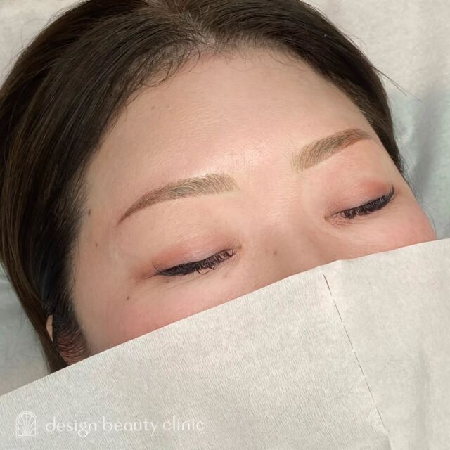 🪄
■お悩み・ご希望：
お悩み：眉尻に毛がないので左右差があり、お化粧に時間がかかる

■施術内容：
毛並み+パウダー(4D)

お写真ご協力ありがとうございました🕊️

➤施術名：アートメイク眉毛　1回33,000円（税込）
➤施術の説明：皮膚の浅い層を専用針で傷をつけて色素を入れることにより、皮膚を着色する施術です。
➤リスク・副作用：炎症症状(発赤・腫脹・熱感・疼痛)、内出血、痒み、アレルギー反応、感染等。

⚠️DMでのお問い合わせはお受けしておりません
お問い合わせは、クリニックへ直接お電話をお願いいたします

‥‥‥‥‥‥‥‥‥‥‥‥‥‥‥‥‥‥‥‥

■医療機関名
デザイン ビューティー クリニック

■ご予約方法
•WEB／LINE（プロフィールからリンクできます）
•電話

■電話番号（問い合わせ・予約）
地域・メニューによって電話番号が異なります。

🌿大阪 アートメイク
　06-6616-8095

🌿東京 アートメイク
　03-6263-2519

🌿名古屋 アートメイク
　052-433-7730

🌿大阪 美容皮膚科
　06-6743-4652

■店舗紹介
アートメイクは下記の5院どこでもお受けいただけます。

─ 梅田エリア ─

📍 梅田本院
大阪府大阪市北区茶屋町15-8 茶屋町ビル2階
営業時間：10:00〜19:00 ／ 定休日：不定休
診療：アートメイク / 美容皮膚科

📍 アートメイク梅田院
大阪府大阪市北区鶴野町2-1 梅田タナダビル1階
営業時間：10:00〜19:00 ／ 定休日：不定休
診療：アートメイク

─ 心斎橋・難波エリア ─

📍 アートメイク心斎橋院
大阪市中央区東心斎橋1-20-14 心斎橋エルナ岩崎ビル5階
営業時間：10:00〜19:00 ／ 定休日：不定休
診療：アートメイク

─ 東京エリア ─

📍アートメイク東京銀座院
東京都中央区銀座1丁目28-16 SUGIURA GINZA 7階
営業時間：10:00〜19:00 ／ 定休日：不定休
診療：アートメイク

─ 愛知エリア ─

📍アートメイク名古屋院
愛知県名古屋市西区名駅3-10-15 名駅三丁目ビル2階
営業時間：10:00〜19:00 ／ 定休日：不定休
診療：アートメイク

‥‥‥‥‥‥‥‥‥‥‥‥‥‥‥‥‥‥‥‥
#アートメイク #アートメイク眉 #アートメイクリップ #アートメイク大阪 #アートメイク東京