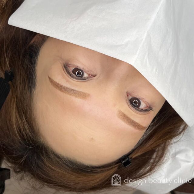 🪄
■お悩み・ご希望：
お悩み：1回目が薄くなった
ご希望：眉頭をもう少し寄せたい

■施術内容：
パウダー(2D)

お写真ご協力ありがとうございました🕊️

➤施術名：アートメイク眉毛　1回33,000円（税込）
➤施術の説明：皮膚の浅い層を専用針で傷をつけて色素を入れることにより、皮膚を着色する施術です。
➤リスク・副作用：炎症症状(発赤・腫脹・熱感・疼痛)、内出血、痒み、アレルギー反応、感染等。

⚠️DMでのお問い合わせはお受けしておりません
お問い合わせは、クリニックへ直接お電話をお願いいたします

‥‥‥‥‥‥‥‥‥‥‥‥‥‥‥‥‥‥‥‥

■医療機関名
デザイン ビューティー クリニック

■ご予約方法
•WEB／LINE（プロフィールからリンクできます）
•電話

■電話番号（問い合わせ・予約）
地域・メニューによって電話番号が異なります。

🌿大阪 アートメイク
　06-6616-8095

🌿東京 アートメイク
　03-6263-2519

🌿名古屋 アートメイク
　052-433-7730

🌿大阪 美容皮膚科
　06-6743-4652

■店舗紹介
アートメイクは下記の5院どこでもお受けいただけます。

─ 梅田エリア ─

📍 梅田本院
大阪府大阪市北区茶屋町15-8 茶屋町ビル2階
営業時間：10:00〜19:00 ／ 定休日：不定休
診療：アートメイク / 美容皮膚科

📍 アートメイク梅田院
大阪府大阪市北区鶴野町2-1 梅田タナダビル1階
営業時間：10:00〜19:00 ／ 定休日：不定休
診療：アートメイク

─ 心斎橋・難波エリア ─

📍 アートメイク心斎橋院
大阪市中央区東心斎橋1-20-14 心斎橋エルナ岩崎ビル5階
営業時間：10:00〜19:00 ／ 定休日：不定休
診療：アートメイク

─ 東京エリア ─

📍アートメイク東京銀座院
東京都中央区銀座1丁目28-16 SUGIURA GINZA 7階
営業時間：10:00〜19:00 ／ 定休日：不定休
診療：アートメイク

─ 愛知エリア ─

📍アートメイク名古屋院
愛知県名古屋市西区名駅3-10-15 名駅三丁目ビル2階
営業時間：10:00〜19:00 ／ 定休日：不定休
診療：アートメイク

‥‥‥‥‥‥‥‥‥‥‥‥‥‥‥‥‥‥‥‥
#アートメイク #アートメイク眉 #アートメイクリップ #アートメイク大阪 #アートメイク東京