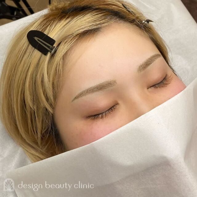 🪄
■お悩み・ご希望：
お悩み：抜きすぎて細くなり形が変わってしまった
ご希望：明るめ、眉山がカクっとしないようにしてほしい

■施術内容：
毛並み+パウダー(4D)

お写真ご協力ありがとうございました🕊️

➤施術名：アートメイク眉毛　1回33,000円（税込）
➤施術の説明：皮膚の浅い層を専用針で傷をつけて色素を入れることにより、皮膚を着色する施術です。
➤リスク・副作用：炎症症状(発赤・腫脹・熱感・疼痛)、内出血、痒み、アレルギー反応、感染等。

⚠️DMでのお問い合わせはお受けしておりません
お問い合わせは、クリニックへ直接お電話をお願いいたします

‥‥‥‥‥‥‥‥‥‥‥‥‥‥‥‥‥‥‥‥

■医療機関名
デザイン ビューティー クリニック

■ご予約方法
•WEB／LINE（プロフィールからリンクできます）
•電話

■電話番号（問い合わせ・予約）
地域・メニューによって電話番号が異なります。

🌿大阪 アートメイク
　06-6616-8095

🌿東京 アートメイク
　03-6263-2519

🌿名古屋 アートメイク
　052-433-7730

🌿大阪 美容皮膚科
　06-6743-4652

■店舗紹介
アートメイクは下記の5院どこでもお受けいただけます。

─ 梅田エリア ─

📍 梅田本院
大阪府大阪市北区茶屋町15-8 茶屋町ビル2階
営業時間：10:00〜19:00 ／ 定休日：不定休
診療：アートメイク / 美容皮膚科

📍 アートメイク梅田院
大阪府大阪市北区鶴野町2-1 梅田タナダビル1階
営業時間：10:00〜19:00 ／ 定休日：不定休
診療：アートメイク

─ 心斎橋・難波エリア ─

📍 アートメイク心斎橋院
大阪市中央区東心斎橋1-20-14 心斎橋エルナ岩崎ビル5階
営業時間：10:00〜19:00 ／ 定休日：不定休
診療：アートメイク

─ 東京エリア ─

📍アートメイク東京銀座院
東京都中央区銀座1丁目28-16 SUGIURA GINZA 7階
営業時間：10:00〜19:00 ／ 定休日：不定休
診療：アートメイク

─ 愛知エリア ─

📍アートメイク名古屋院
愛知県名古屋市西区名駅3-10-15 名駅三丁目ビル2階
営業時間：10:00〜19:00 ／ 定休日：不定休
診療：アートメイク

‥‥‥‥‥‥‥‥‥‥‥‥‥‥‥‥‥‥‥‥
#アートメイク #アートメイク眉 #アートメイクリップ #アートメイク大阪 #アートメイク東京