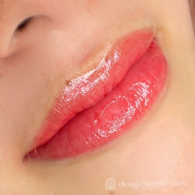💋
■お悩み・ご希望：
お悩み：血色がなく、顔色が悪く見えてしまう

■施術内容：
リップアートメイク

お写真ご協力ありがとうございました🕊️

➤施術名：アートメイクリップ　1回44,000円（税込）
➤施術の説明：皮膚の浅い層を専用針で傷をつけて色素を入れることにより、皮膚を着色する施術です。
➤リスク・副作用：炎症症状(発赤・腫脹・熱感・疼痛)、内出血、痒み、アレルギー反応、感染等。

⚠️DMでのお問い合わせはお受けしておりません
お問い合わせは、クリニックへ直接お電話をお願いいたします

‥‥‥‥‥‥‥‥‥‥‥‥‥‥‥‥‥‥‥‥

■医療機関名
デザイン ビューティー クリニック

■ご予約方法
•WEB／LINE（プロフィールからリンクできます）
•電話

■電話番号（問い合わせ・予約）
地域・メニューによって電話番号が異なります。

🌿大阪 アートメイク
　06-6616-8095

🌿東京 アートメイク
　03-6263-2519

🌿名古屋 アートメイク
　052-433-7730

🌿大阪 美容皮膚科
　06-6743-4652

■店舗紹介
アートメイクは下記の5院どこでもお受けいただけます。

─ 梅田エリア ─

📍 梅田本院
大阪府大阪市北区茶屋町15-8 茶屋町ビル2階
営業時間：10:00〜19:00 ／ 定休日：不定休
診療：アートメイク / 美容皮膚科

📍 アートメイク梅田院
大阪府大阪市北区鶴野町2-1 梅田タナダビル1階
営業時間：10:00〜19:00 ／ 定休日：不定休
診療：アートメイク

─ 心斎橋・難波エリア ─

📍 アートメイク心斎橋院
大阪市中央区東心斎橋1-20-14 心斎橋エルナ岩崎ビル5階
営業時間：10:00〜19:00 ／ 定休日：不定休
診療：アートメイク

─ 東京エリア ─

📍アートメイク東京銀座院
東京都中央区銀座1丁目28-16 SUGIURA GINZA 7階
営業時間：10:00〜19:00 ／ 定休日：不定休
診療：アートメイク

─ 愛知エリア ─

📍アートメイク名古屋院
愛知県名古屋市西区名駅3-10-15 名駅三丁目ビル2階
営業時間：10:00〜19:00 ／ 定休日：不定休
診療：アートメイク

‥‥‥‥‥‥‥‥‥‥‥‥‥‥‥‥‥‥‥‥
#アートメイク #アートメイク眉 #アートメイクリップ #アートメイク大阪 #アートメイク東京