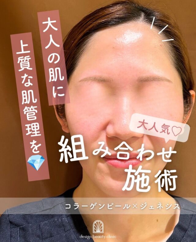 .
✨ハリ・ツヤ・なめらかさを、ひとつの肌へ✨

「肌のくすみが気になる」
「ハリがなくなってきた」
「毛穴やキメの乱れが気になる」
「ツヤのある肌を目指したい」

そんな複数の肌悩みにおすすめなのが、
コラーゲンピール × ジェネシスの組み合わせです🤍

🫧 コラーゲンピール
肌に薬剤を塗布し、コラーゲン生成を促すことで、
ハリ・弾力・ツヤのある肌を目指します。

✨ ジェネシス
レーザーの熱作用によって肌をじんわり温め、
赤み・毛穴・キメなどの肌悩みをケアします。

それぞれ異なるアプローチで肌に働きかけることで、
ハリ・ツヤ・なめらかさをトータルにケア。

「何となく肌の調子が上がらない」
そんなときの肌管理にもおすすめです🌿

自分の肌に合った施術を取り入れて、
素肌の美しさを少しずつ育てていきませんか？

【コラーゲンピール】
初回：9,800円
通常：15,800円
平日3回コース：29,400円
全日3回コース：39,400円
※全て税込価格

【ジェネシス】
初回3000shot：7,800円
通常3000shot：10,800円
初回6000shot：13,600円
通常6000shot：18,800円

⚠️DMでのお問い合わせはお受けしておりません
お問い合わせは、クリニックへ直接お電話をお願いいたします🌱

-———————————

ACCESS：大阪府大阪市北区茶屋町15-8
茶屋町ビル2階
TEL：06-6743-4652
営業時間：10時〜17時
(最終受付時間：16時)
お問合せ受付時間：10時〜19時

#美容皮膚科 #美容クリニック #美肌 #女医 #肌質改善