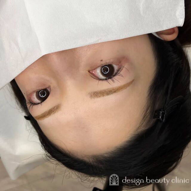 🪄
■お悩み・ご希望：
お悩み：メイクが面倒
ご希望：平行セミアーチくらいで淡めがいい

■施術内容：
パウダー(3D)

お写真ご協力ありがとうございました🕊️

➤施術名：アートメイク眉毛　1回33,000円（税込）
➤施術の説明：皮膚の浅い層を専用針で傷をつけて色素を入れることにより、皮膚を着色する施術です。
➤リスク・副作用：炎症症状(発赤・腫脹・熱感・疼痛)、内出血、痒み、アレルギー反応、感染等。

⚠️DMでのお問い合わせはお受けしておりません
お問い合わせは、クリニックへ直接お電話をお願いいたします

‥‥‥‥‥‥‥‥‥‥‥‥‥‥‥‥‥‥‥‥

■医療機関名
デザイン ビューティー クリニック

■ご予約方法
•WEB／LINE（プロフィールからリンクできます）
•電話

■電話番号（問い合わせ・予約）
地域・メニューによって電話番号が異なります。

🌿大阪 アートメイク
　06-6616-8095

🌿東京 アートメイク
　03-6263-2519

🌿名古屋 アートメイク
　052-433-7730

🌿大阪 美容皮膚科
　06-6743-4652

■店舗紹介
アートメイクは下記の5院どこでもお受けいただけます。

─ 梅田エリア ─

📍 梅田本院
大阪府大阪市北区茶屋町15-8 茶屋町ビル2階
営業時間：10:00〜19:00 ／ 定休日：不定休
診療：アートメイク / 美容皮膚科

📍 アートメイク梅田院
大阪府大阪市北区鶴野町2-1 梅田タナダビル1階
営業時間：10:00〜19:00 ／ 定休日：不定休
診療：アートメイク

─ 心斎橋・難波エリア ─

📍 アートメイク心斎橋院
大阪市中央区東心斎橋1-20-14 心斎橋エルナ岩崎ビル5階
営業時間：10:00〜19:00 ／ 定休日：不定休
診療：アートメイク

─ 東京エリア ─

📍アートメイク東京銀座院
東京都中央区銀座1丁目28-16 SUGIURA GINZA 7階
営業時間：10:00〜19:00 ／ 定休日：不定休
診療：アートメイク

─ 愛知エリア ─

📍アートメイク名古屋院
愛知県名古屋市西区名駅3-10-15 名駅三丁目ビル2階
営業時間：10:00〜19:00 ／ 定休日：不定休
診療：アートメイク

‥‥‥‥‥‥‥‥‥‥‥‥‥‥‥‥‥‥‥‥
#アートメイク #アートメイク眉 #アートメイクリップ #アートメイク大阪 #アートメイク東京
