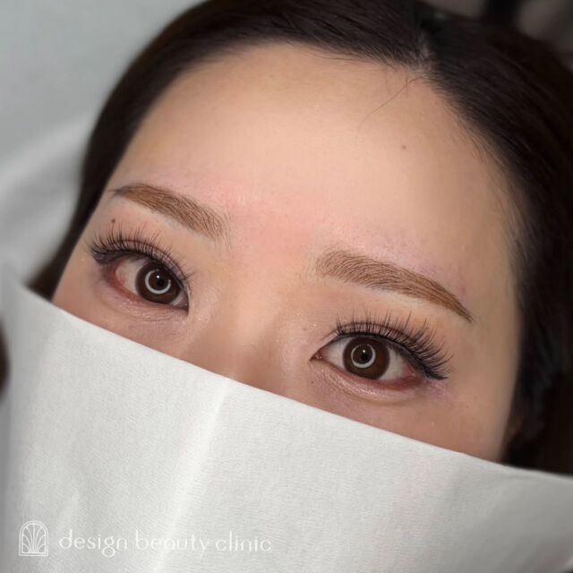 🪄
■お悩み・ご希望：
お悩み：メイクを楽にしたい
ご希望：自分に似合う眉にしてほしい

■施術内容：
パウダー(2D)

お写真ご協力ありがとうございました🕊️

➤施術名：アートメイク眉毛　1回33,000円（税込）
➤施術の説明：皮膚の浅い層を専用針で傷をつけて色素を入れることにより、皮膚を着色する施術です。
➤リスク・副作用：炎症症状(発赤・腫脹・熱感・疼痛)、内出血、痒み、アレルギー反応、感染等。

⚠️DMでのお問い合わせはお受けしておりません
お問い合わせは、クリニックへ直接お電話をお願いいたします

‥‥‥‥‥‥‥‥‥‥‥‥‥‥‥‥‥‥‥‥

■医療機関名
デザイン ビューティー クリニック

■ご予約方法
•WEB／LINE（プロフィールからリンクできます）
•電話

■電話番号（問い合わせ・予約）
地域・メニューによって電話番号が異なります。

🌿大阪 アートメイク
　06-6616-8095

🌿東京 アートメイク
　03-6263-2519

🌿名古屋 アートメイク
　052-433-7730

🌿大阪 美容皮膚科
　06-6743-4652

■店舗紹介
アートメイクは下記の5院どこでもお受けいただけます。

─ 梅田エリア ─

📍 梅田本院
大阪府大阪市北区茶屋町15-8 茶屋町ビル2階
営業時間：10:00〜19:00 ／ 定休日：不定休
診療：アートメイク / 美容皮膚科

📍 アートメイク梅田院
大阪府大阪市北区鶴野町2-1 梅田タナダビル1階
営業時間：10:00〜19:00 ／ 定休日：不定休
診療：アートメイク

─ 心斎橋・難波エリア ─

📍 アートメイク心斎橋院
大阪市中央区東心斎橋1-20-14 心斎橋エルナ岩崎ビル5階
営業時間：10:00〜19:00 ／ 定休日：不定休
診療：アートメイク

─ 東京エリア ─

📍アートメイク東京銀座院
東京都中央区銀座1丁目28-16 SUGIURA GINZA 7階
営業時間：10:00〜19:00 ／ 定休日：不定休
診療：アートメイク

─ 愛知エリア ─

📍アートメイク名古屋院
愛知県名古屋市西区名駅3-10-15 名駅三丁目ビル2階
営業時間：10:00〜19:00 ／ 定休日：不定休
診療：アートメイク

‥‥‥‥‥‥‥‥‥‥‥‥‥‥‥‥‥‥‥‥
#アートメイク #アートメイク眉 #アートメイクリップ #アートメイク大阪 #アートメイク東京