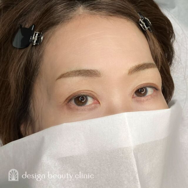 🪄
■お悩み・ご希望：
お悩み：メイクを楽にしたい
ご希望：自眉より緩やかな形

■施術内容：
毛並み+パウダー(4D)

お写真ご協力ありがとうございました🕊️

➤施術名：アートメイク眉毛　1回33,000円（税込）
➤施術の説明：皮膚の浅い層を専用針で傷をつけて色素を入れることにより、皮膚を着色する施術です。
➤リスク・副作用：炎症症状(発赤・腫脹・熱感・疼痛)、内出血、痒み、アレルギー反応、感染等。

⚠️DMでのお問い合わせはお受けしておりません
お問い合わせは、クリニックへ直接お電話をお願いいたします

‥‥‥‥‥‥‥‥‥‥‥‥‥‥‥‥‥‥‥‥

■医療機関名
デザイン ビューティー クリニック

■ご予約方法
•WEB／LINE（プロフィールからリンクできます）
•電話

■電話番号（問い合わせ・予約）
地域・メニューによって電話番号が異なります。

🌿大阪 アートメイク
　06-6616-8095

🌿東京 アートメイク
　03-6263-2519

🌿名古屋 アートメイク
　052-433-7730

🌿大阪 美容皮膚科
　06-6743-4652

■店舗紹介
アートメイクは下記の5院どこでもお受けいただけます。

─ 梅田エリア ─

📍 梅田本院
大阪府大阪市北区茶屋町15-8 茶屋町ビル2階
営業時間：10:00〜19:00 ／ 定休日：不定休
診療：アートメイク / 美容皮膚科

📍 アートメイク梅田院
大阪府大阪市北区鶴野町2-1 梅田タナダビル1階
営業時間：10:00〜19:00 ／ 定休日：不定休
診療：アートメイク

─ 心斎橋・難波エリア ─

📍 アートメイク心斎橋院
大阪市中央区東心斎橋1-20-14 心斎橋エルナ岩崎ビル5階
営業時間：10:00〜19:00 ／ 定休日：不定休
診療：アートメイク

─ 東京エリア ─

📍アートメイク東京銀座院
東京都中央区銀座1丁目28-16 SUGIURA GINZA 7階
営業時間：10:00〜19:00 ／ 定休日：不定休
診療：アートメイク

─ 愛知エリア ─

📍アートメイク名古屋院
愛知県名古屋市西区名駅3-10-15 名駅三丁目ビル2階
営業時間：10:00〜19:00 ／ 定休日：不定休
診療：アートメイク

‥‥‥‥‥‥‥‥‥‥‥‥‥‥‥‥‥‥‥‥
#アートメイク #アートメイク眉 #アートメイクリップ #アートメイク大阪 #アートメイク東京